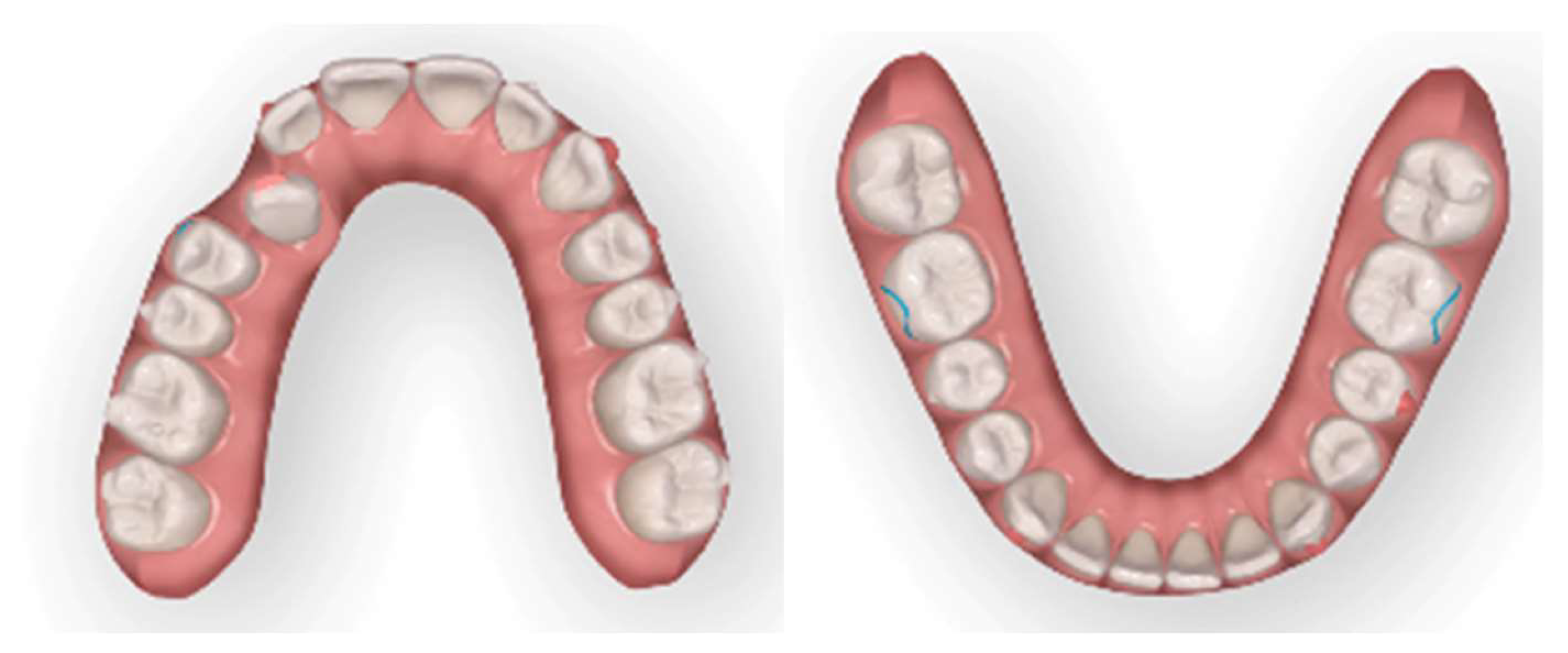 Applsci 13 06914 g007b