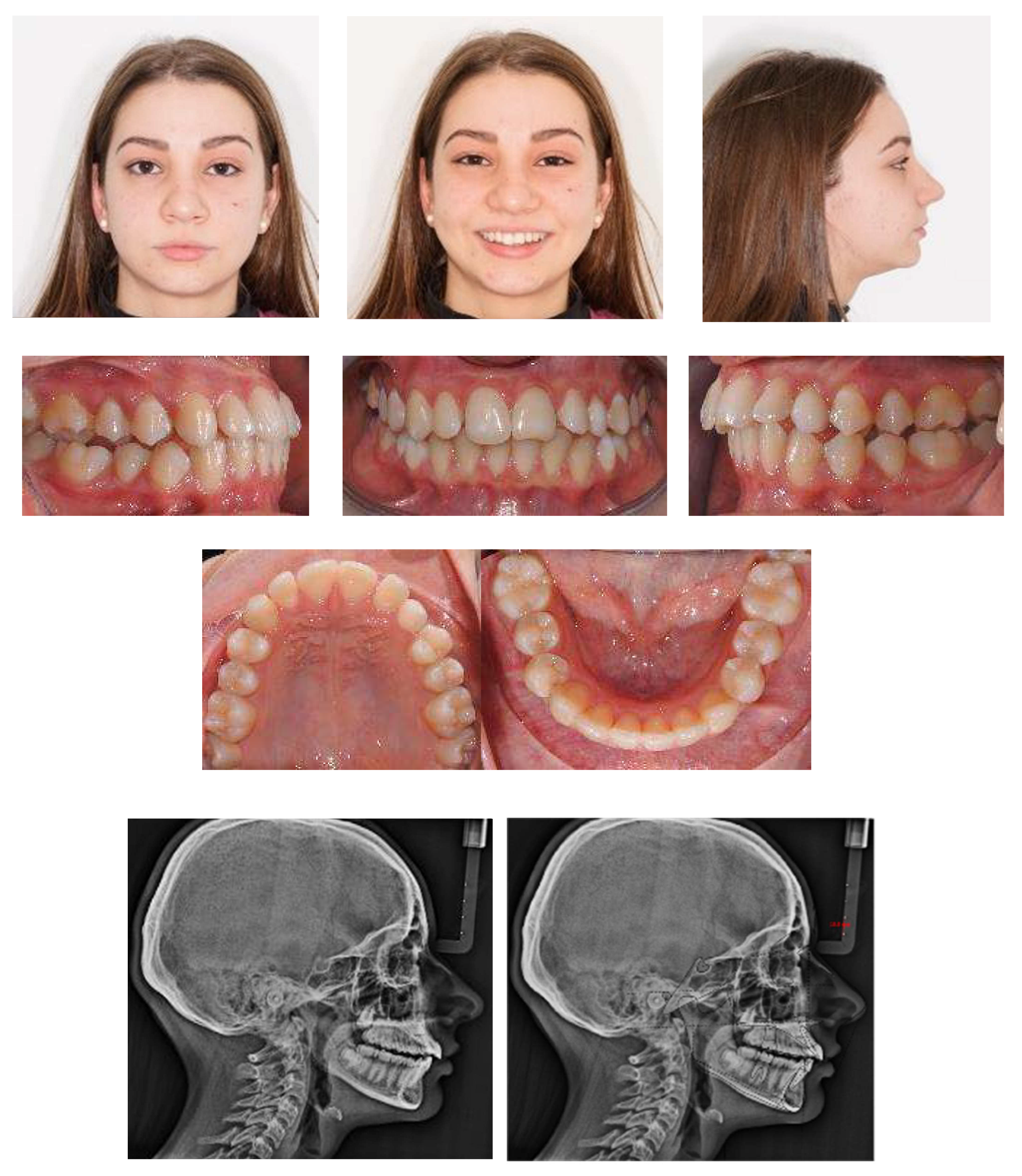 Applsci 13 06914 g011a