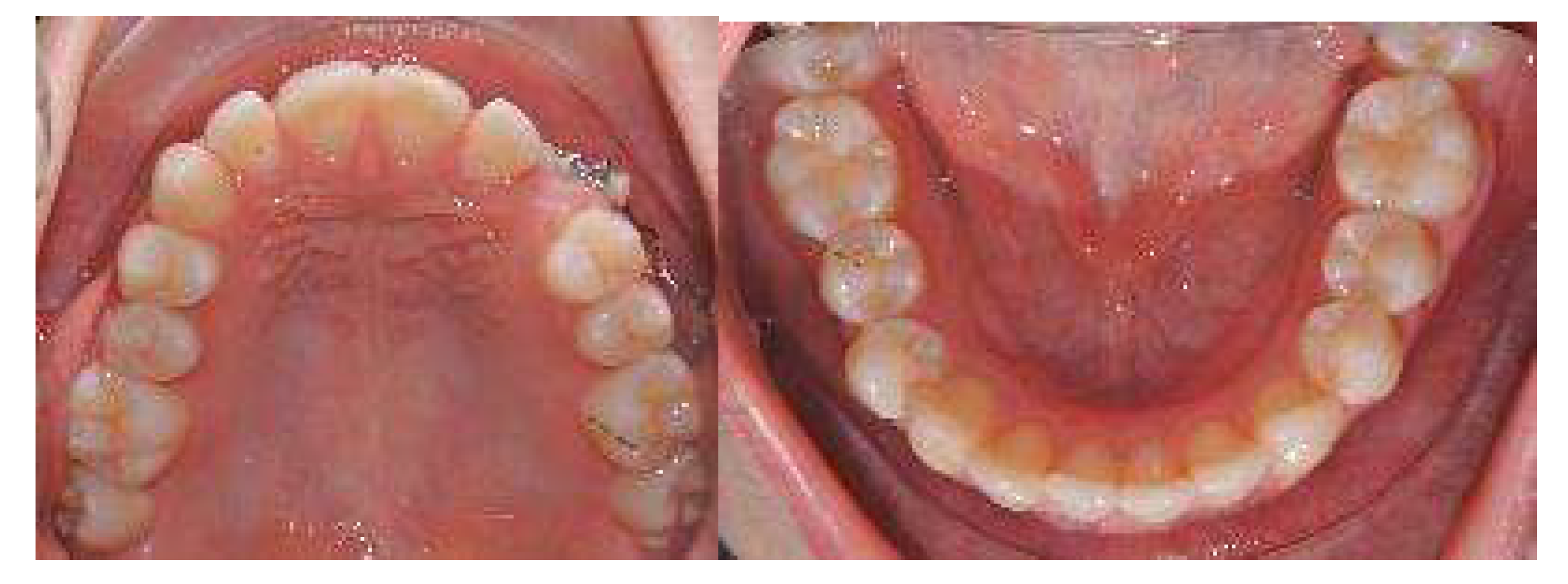 Applsci 13 06914 g013b