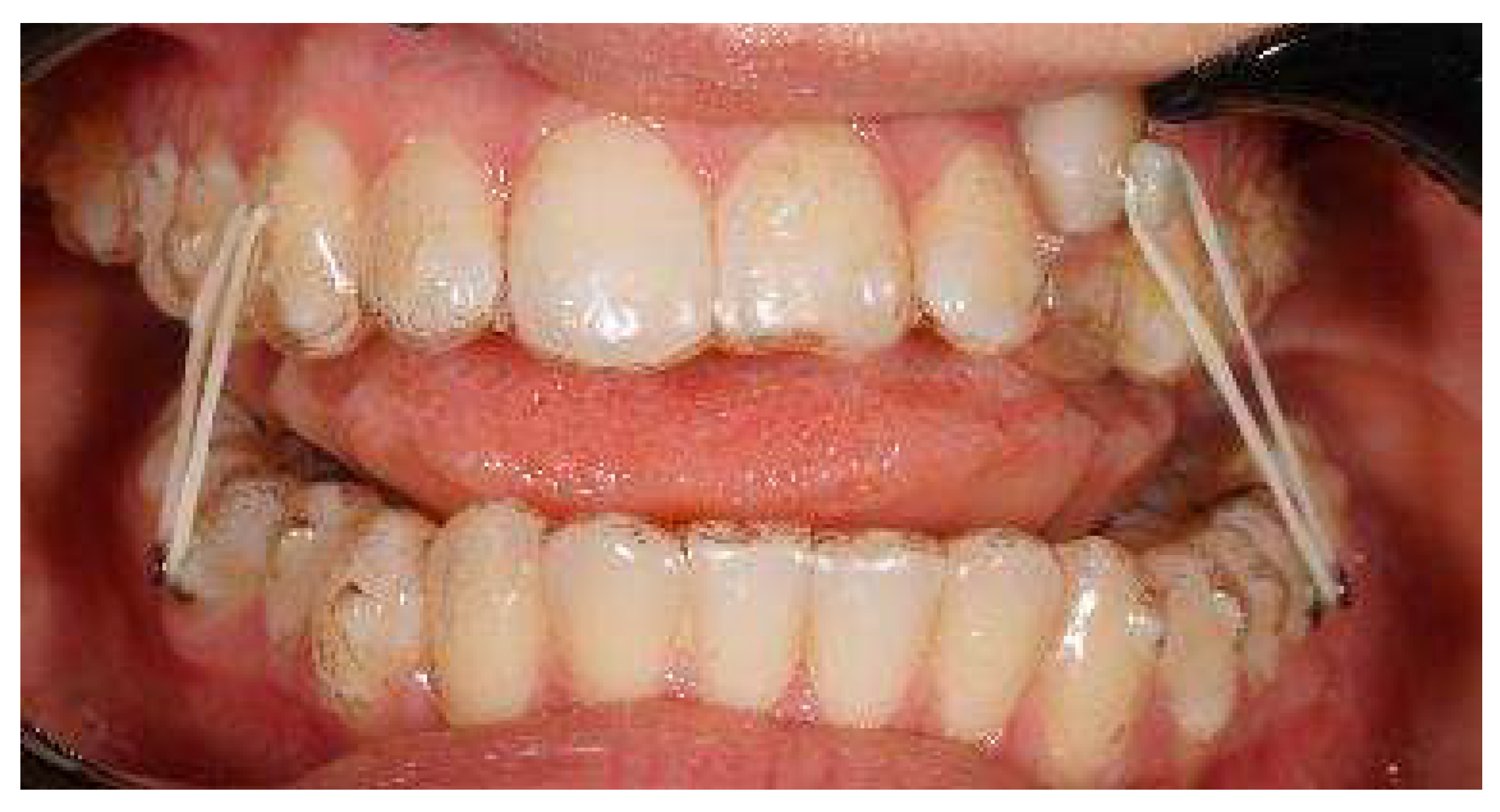 Applsci 13 06914 g014b