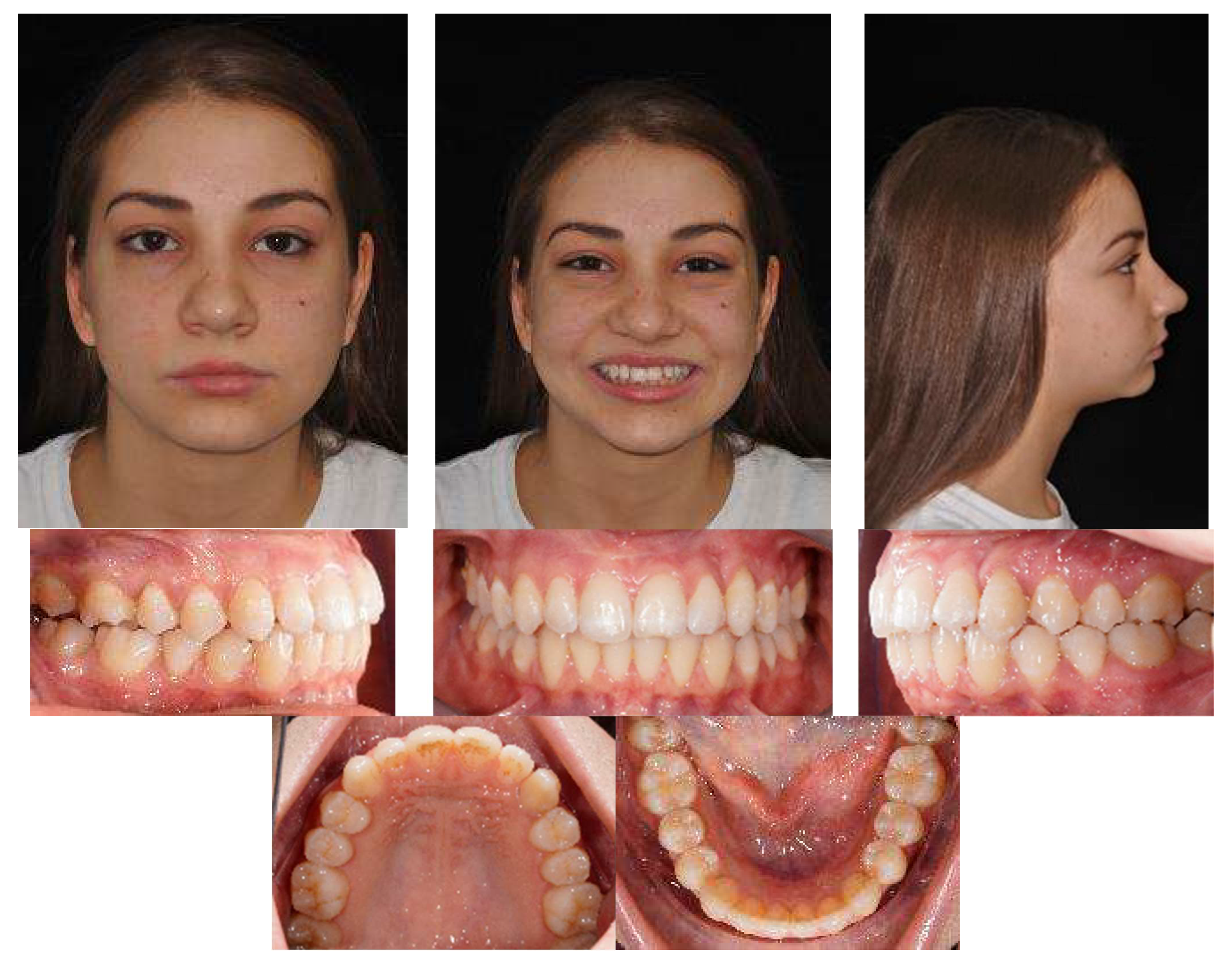 Applsci 13 06914 g017