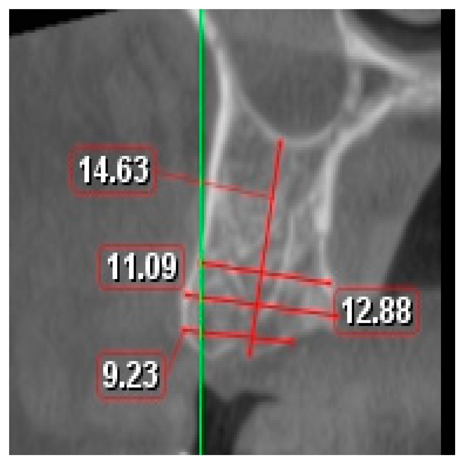 Applsci 13 07076 g001