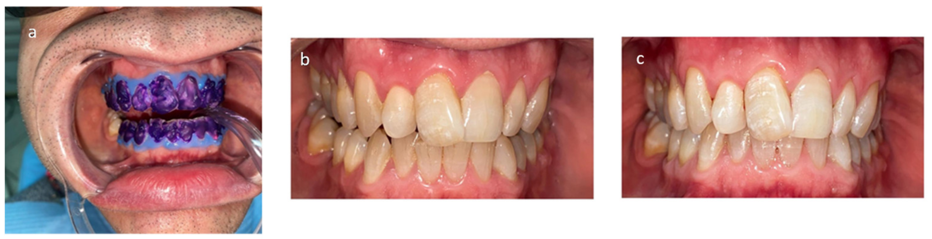 Applsci 13 07089 g005 Applsci 13 07089 g005