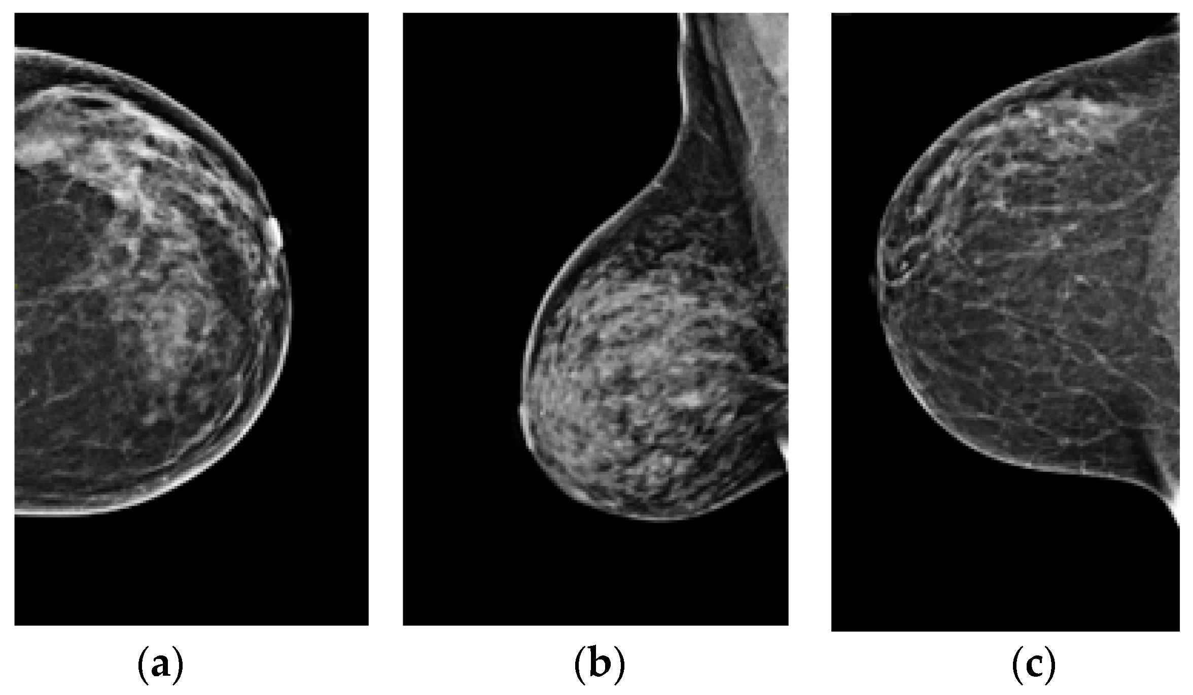 Applied Sciences | Free Full-Text | Breast Cancer Detection in the ...