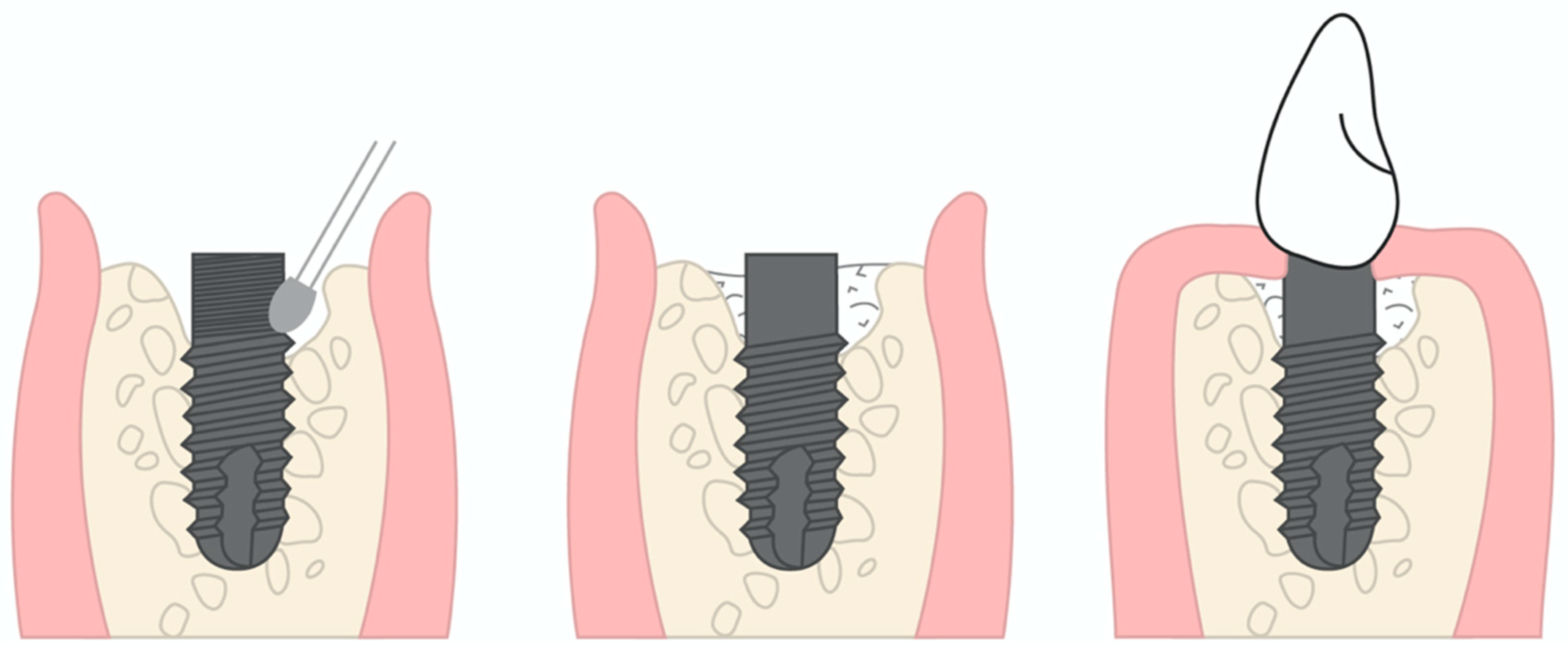 Applsci 13 07224 g004 Applsci 13 07224 g004