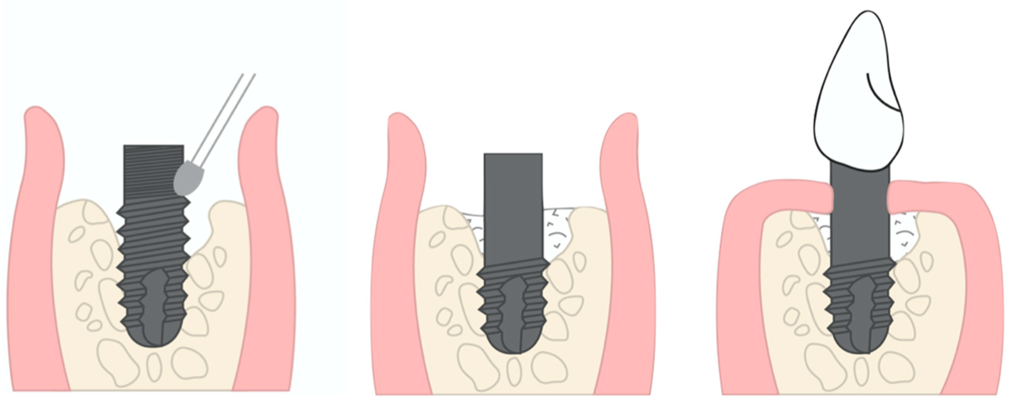 Applsci 13 07224 g005 Applsci 13 07224 g005