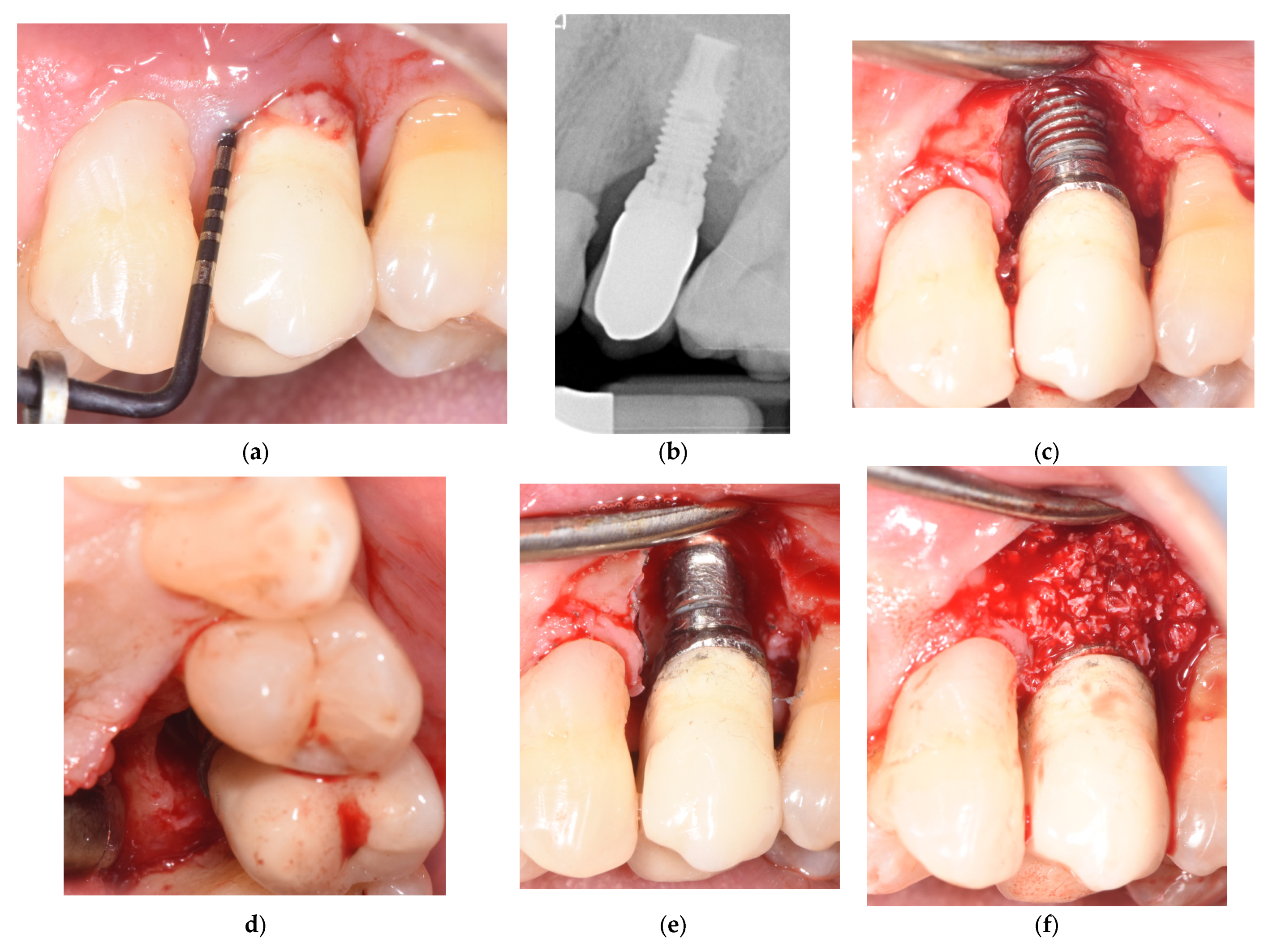 Applsci 13 07224 g006a Applsci 13 07224 g006a