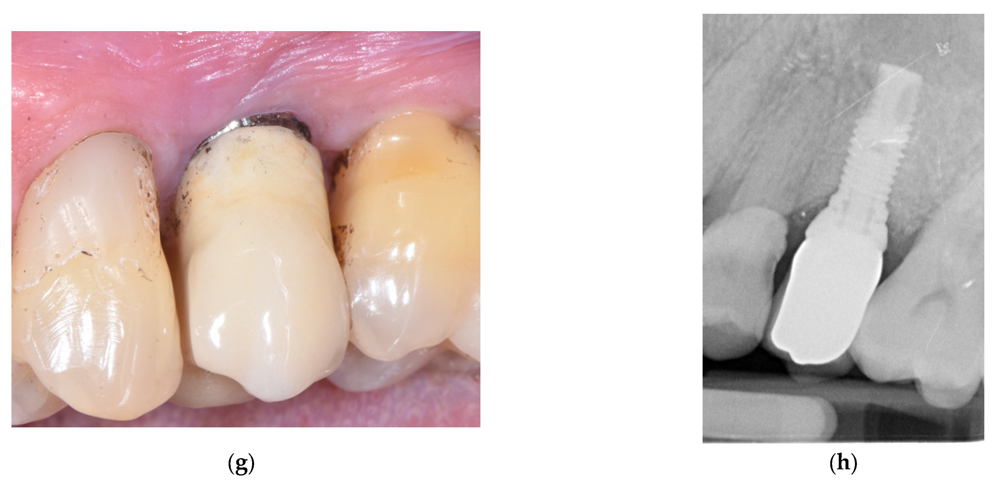 Applsci 13 07224 g006b Applsci 13 07224 g006b