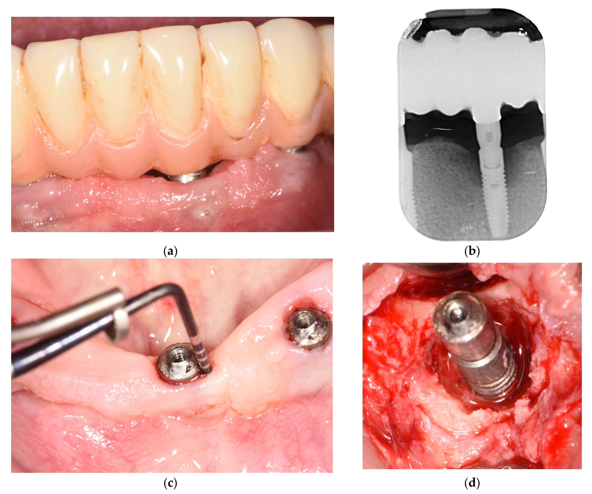 Applsci 13 07224 g007a Applsci 13 07224 g007a