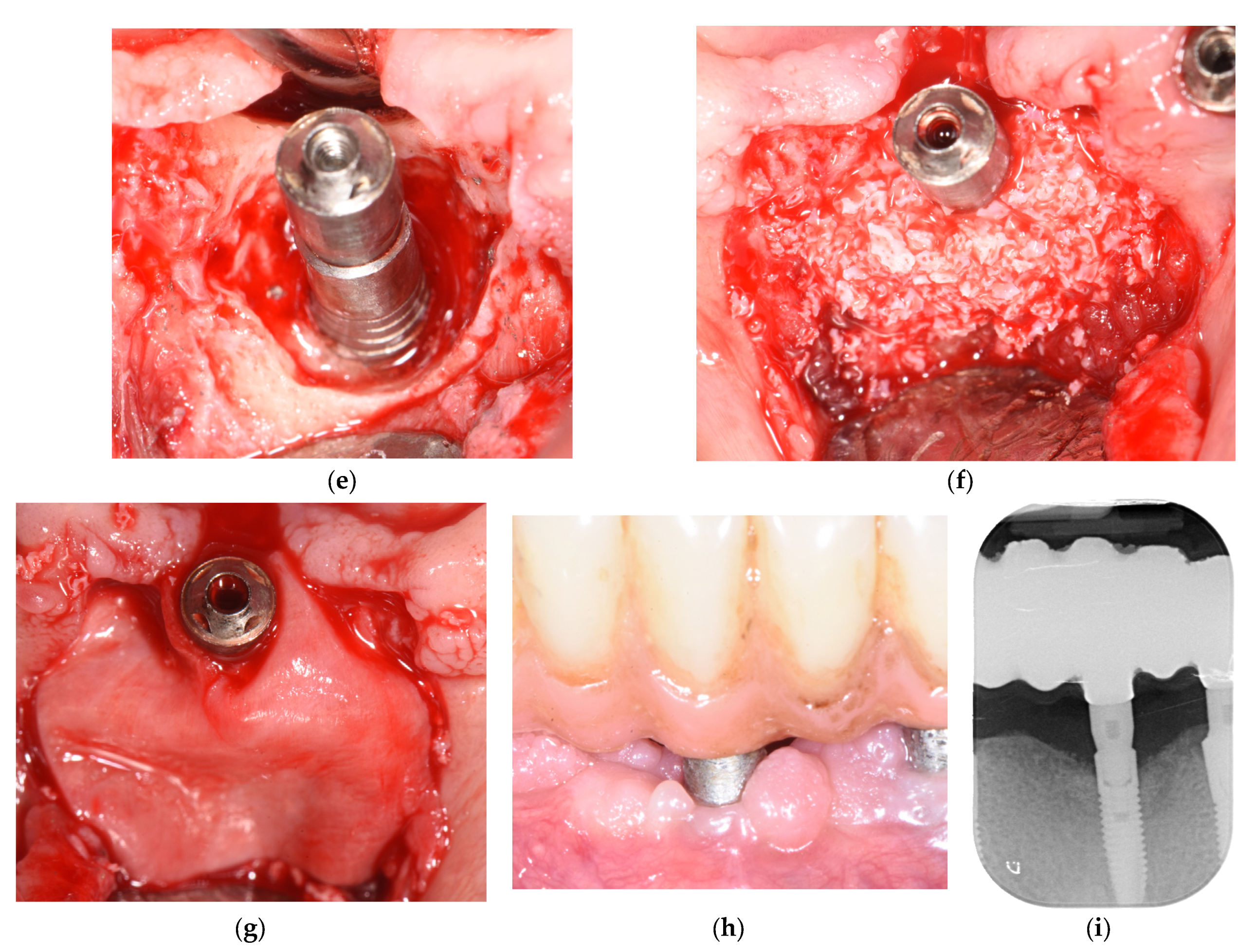 Applsci 13 07224 g007b Applsci 13 07224 g007b