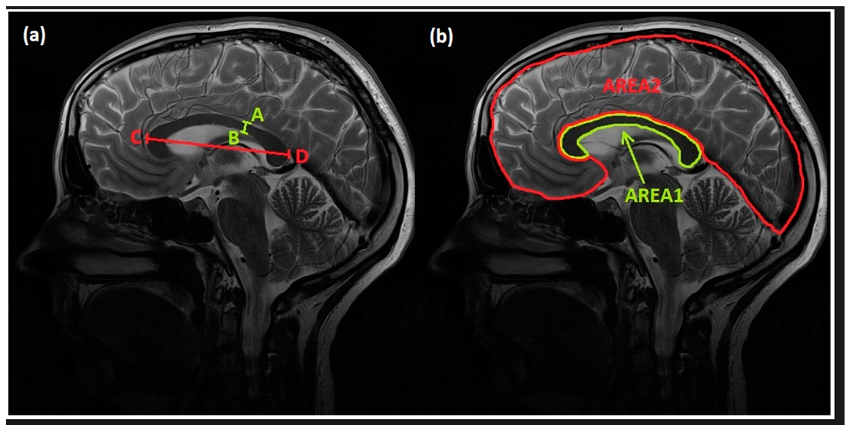 Applied Sciences Free FullText Assessment of the Central Nervous