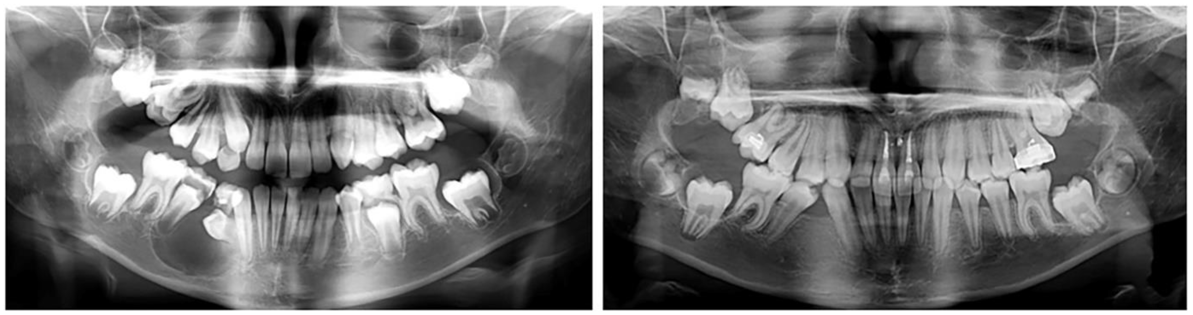 Applsci 13 07353 g005