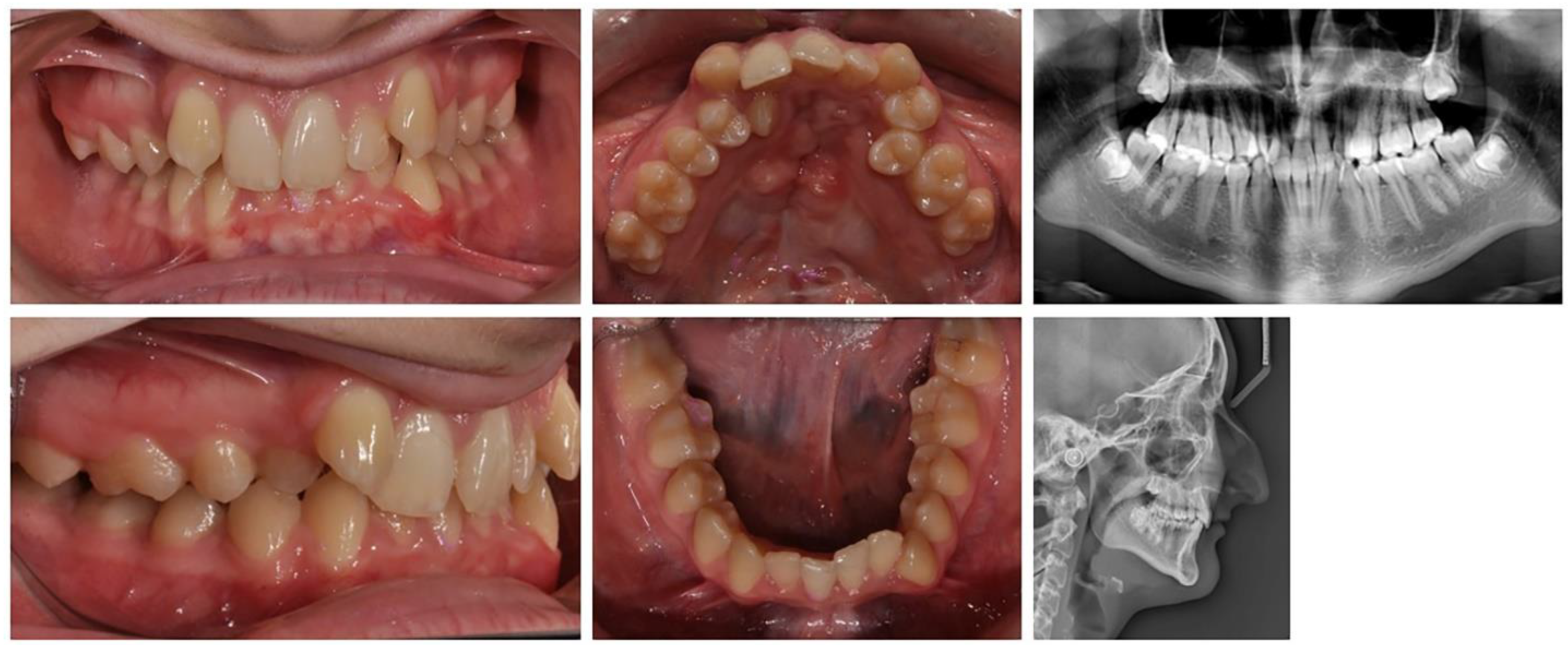 Applsci 13 07353 g006