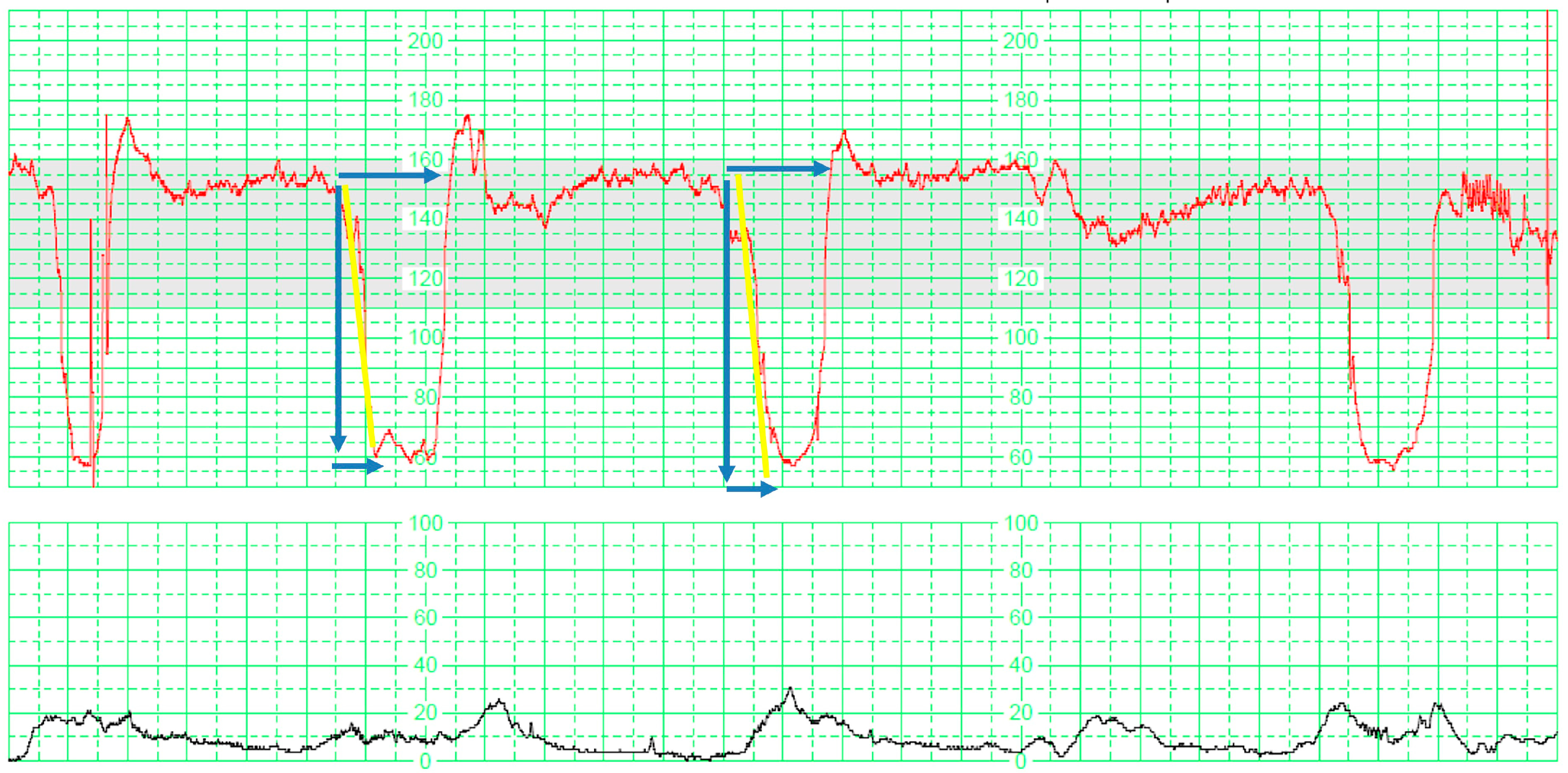 Applsci 13 07478 g004