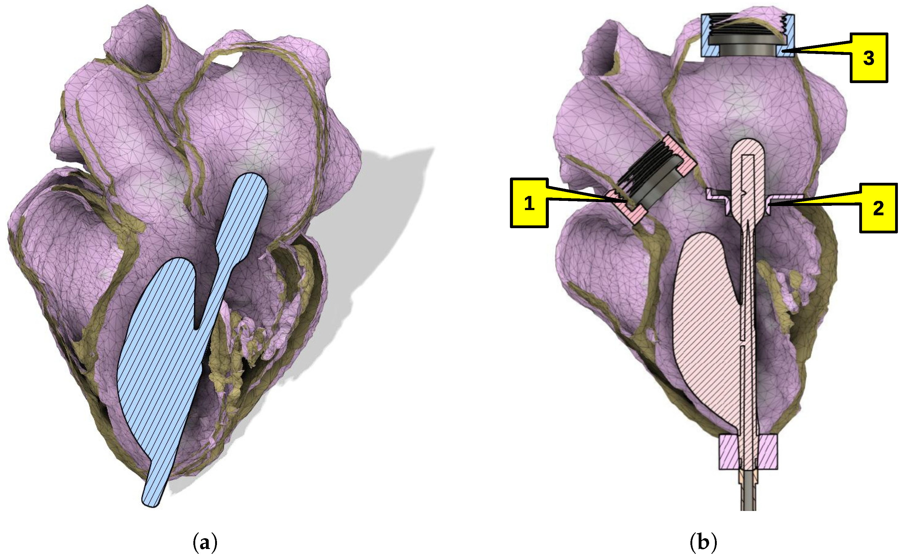 Applsci 13 07785 g004