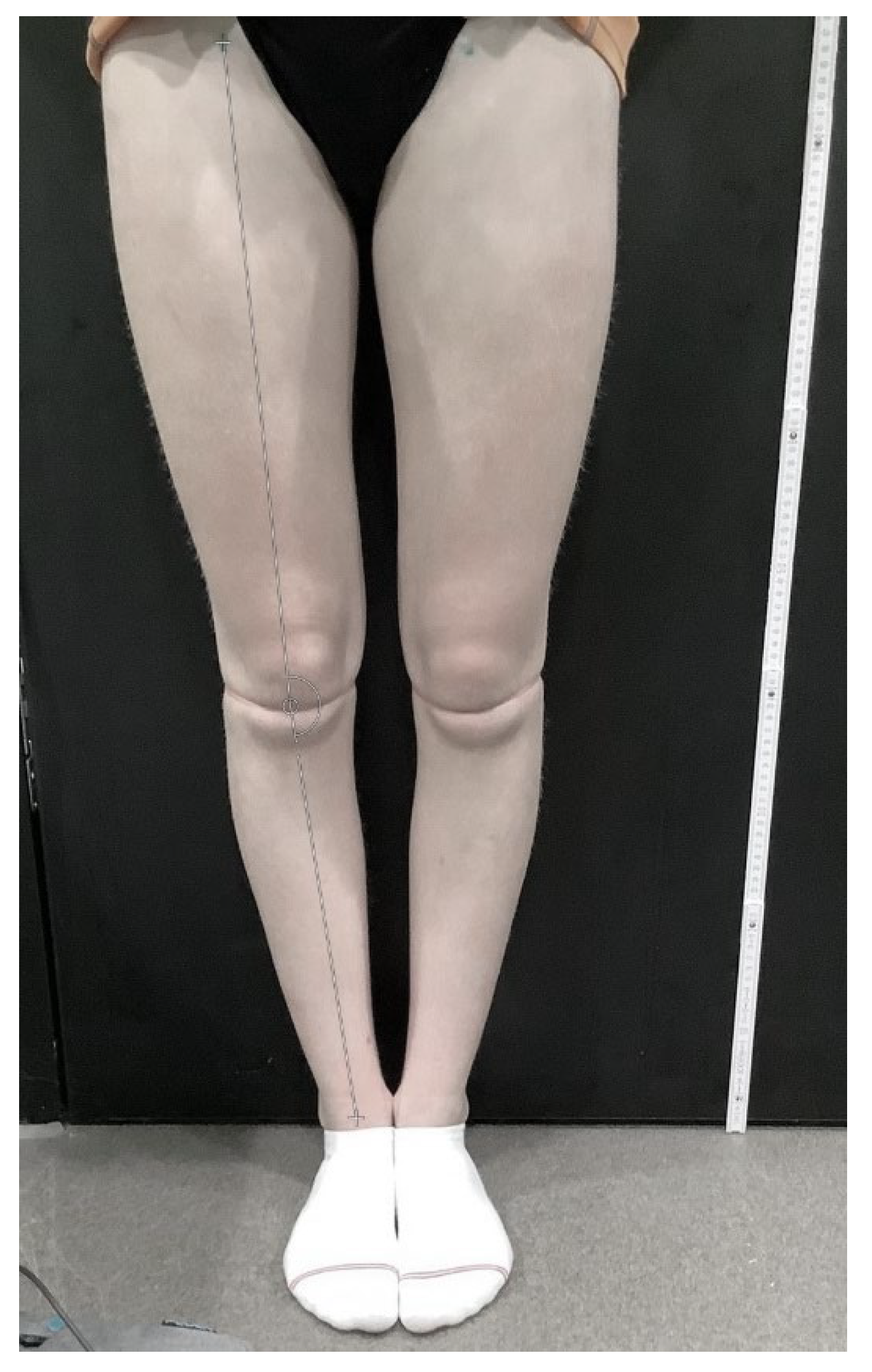 Applied Sciences Free FullText Playing Football as a Risk Factor