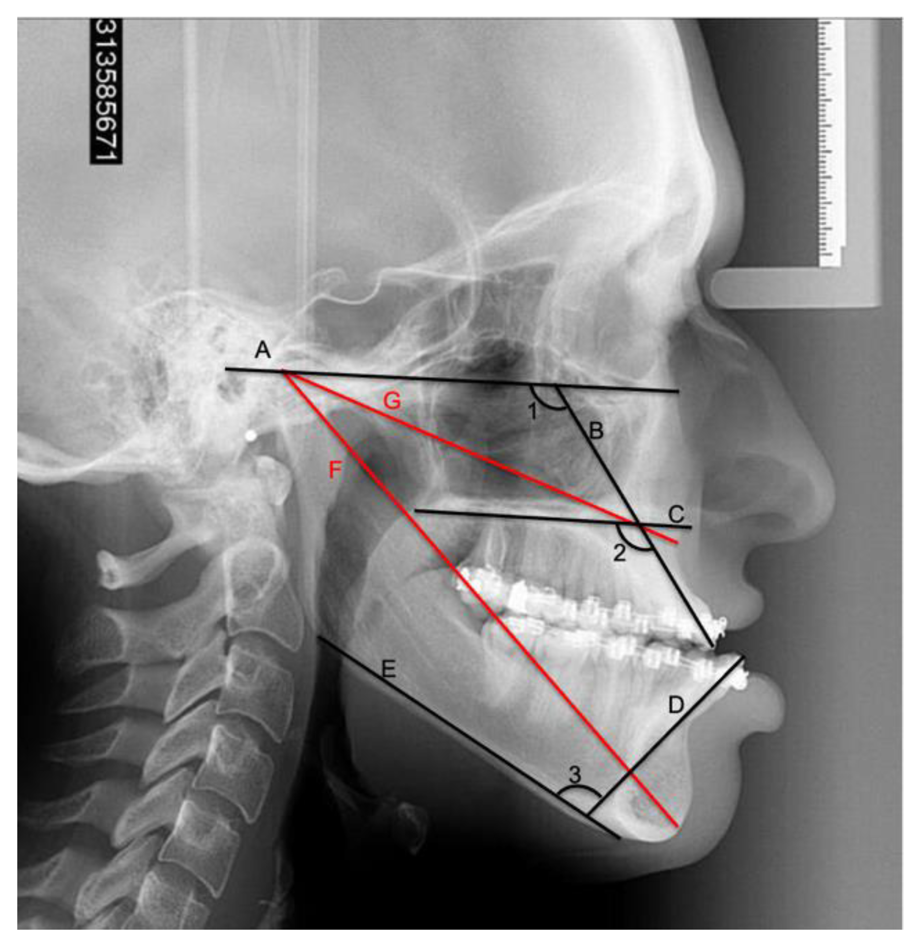 Zwfmockaitis Orthodontics 92 - t2qjlbk