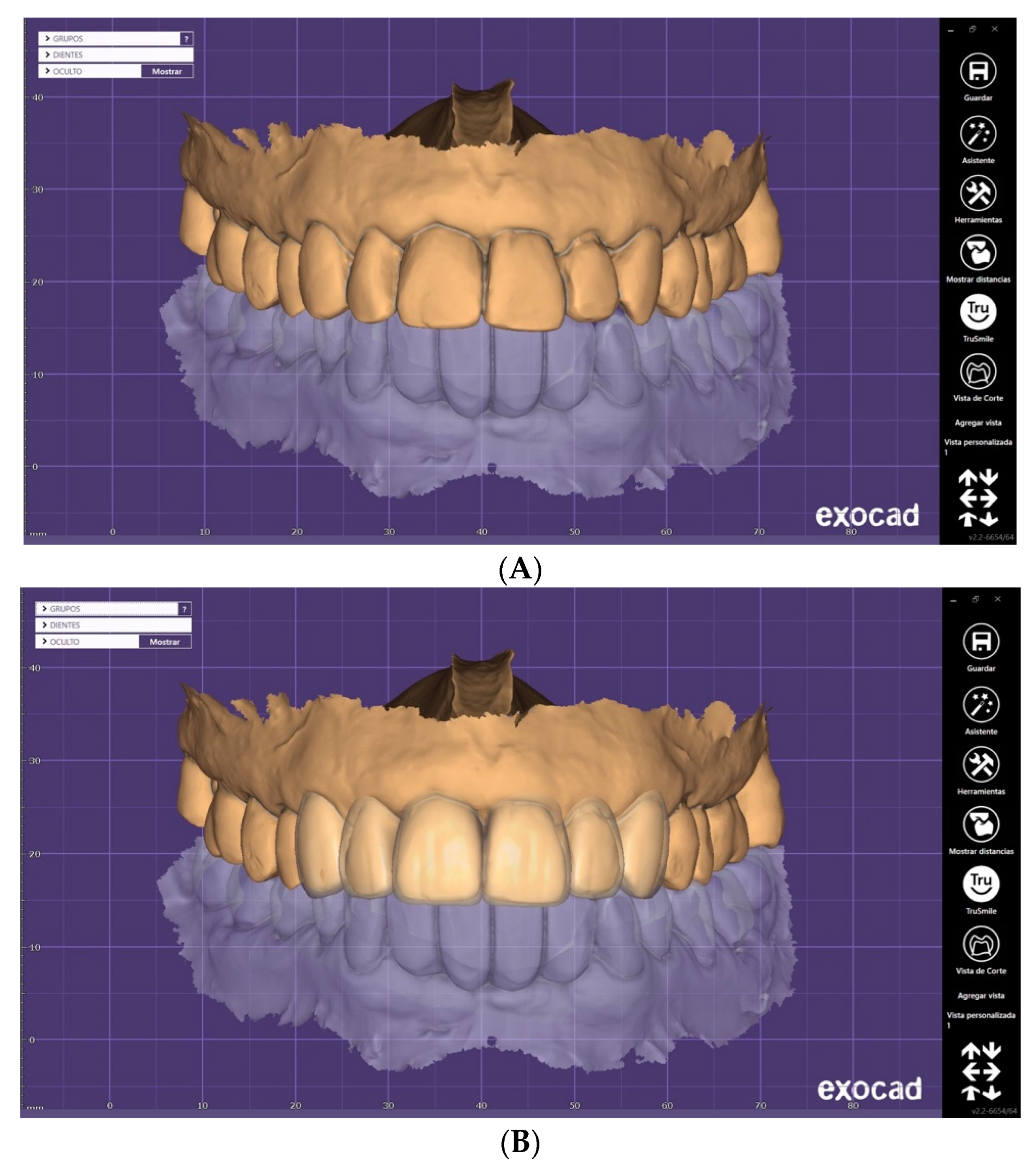 Applsci 13 08243 g004a