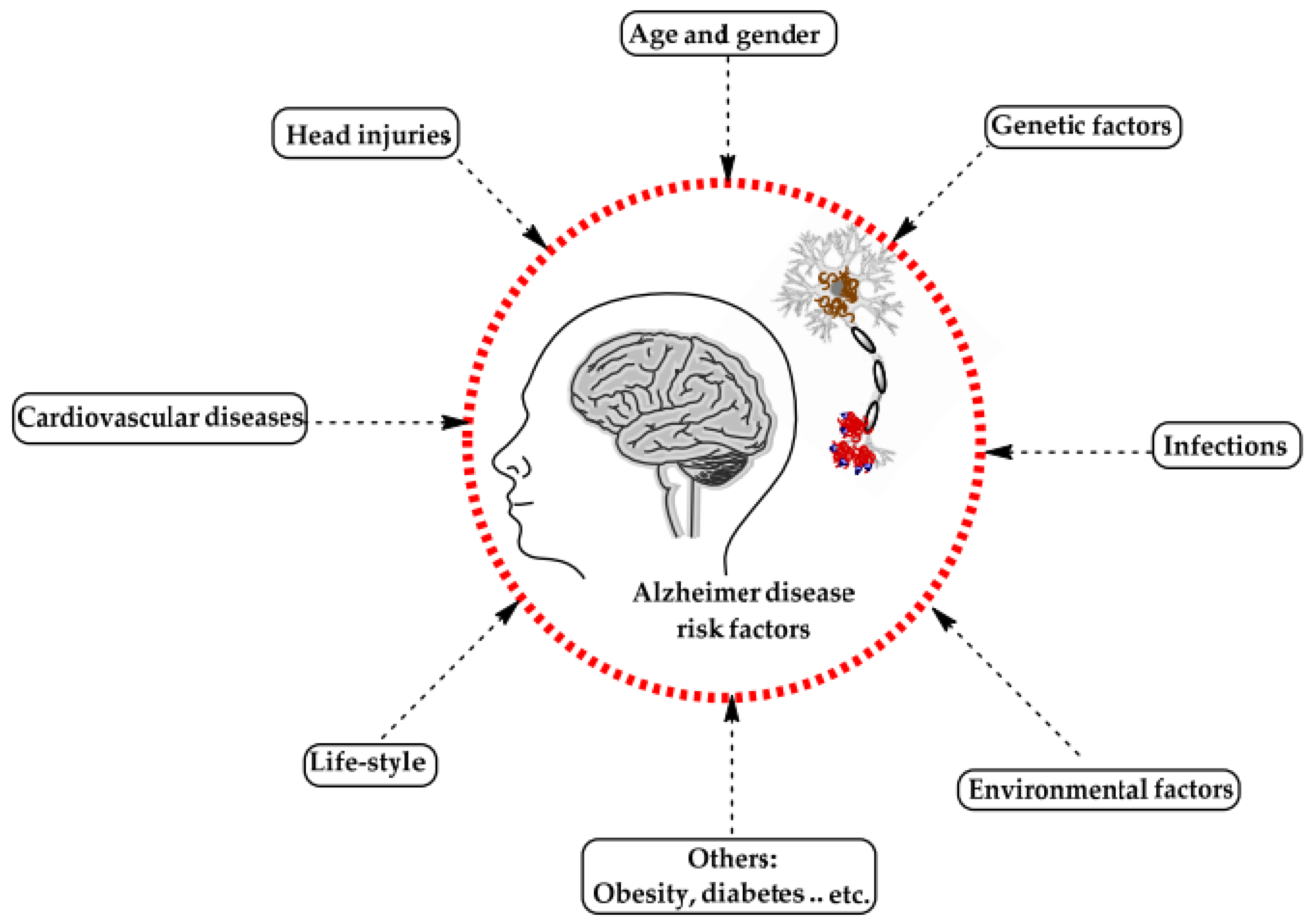 Alzheimer'S: The Inheritance Factor - 8sm9pbt