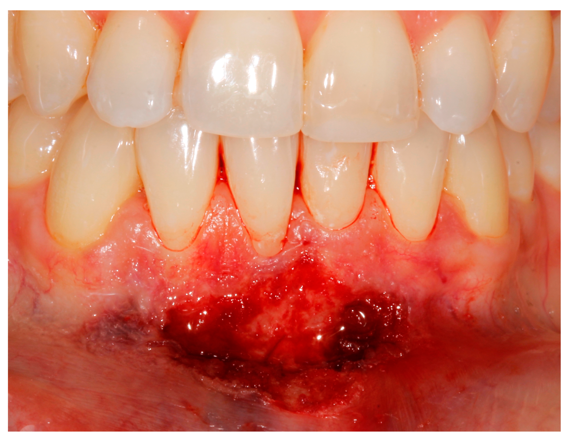 Applsci 13 08979 g004 Applsci 13 08979 g004