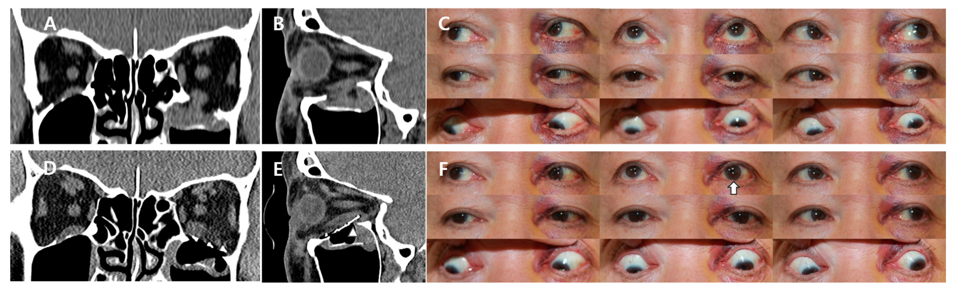 Applsci 13 09012 g005 Applsci 13 09012 g005