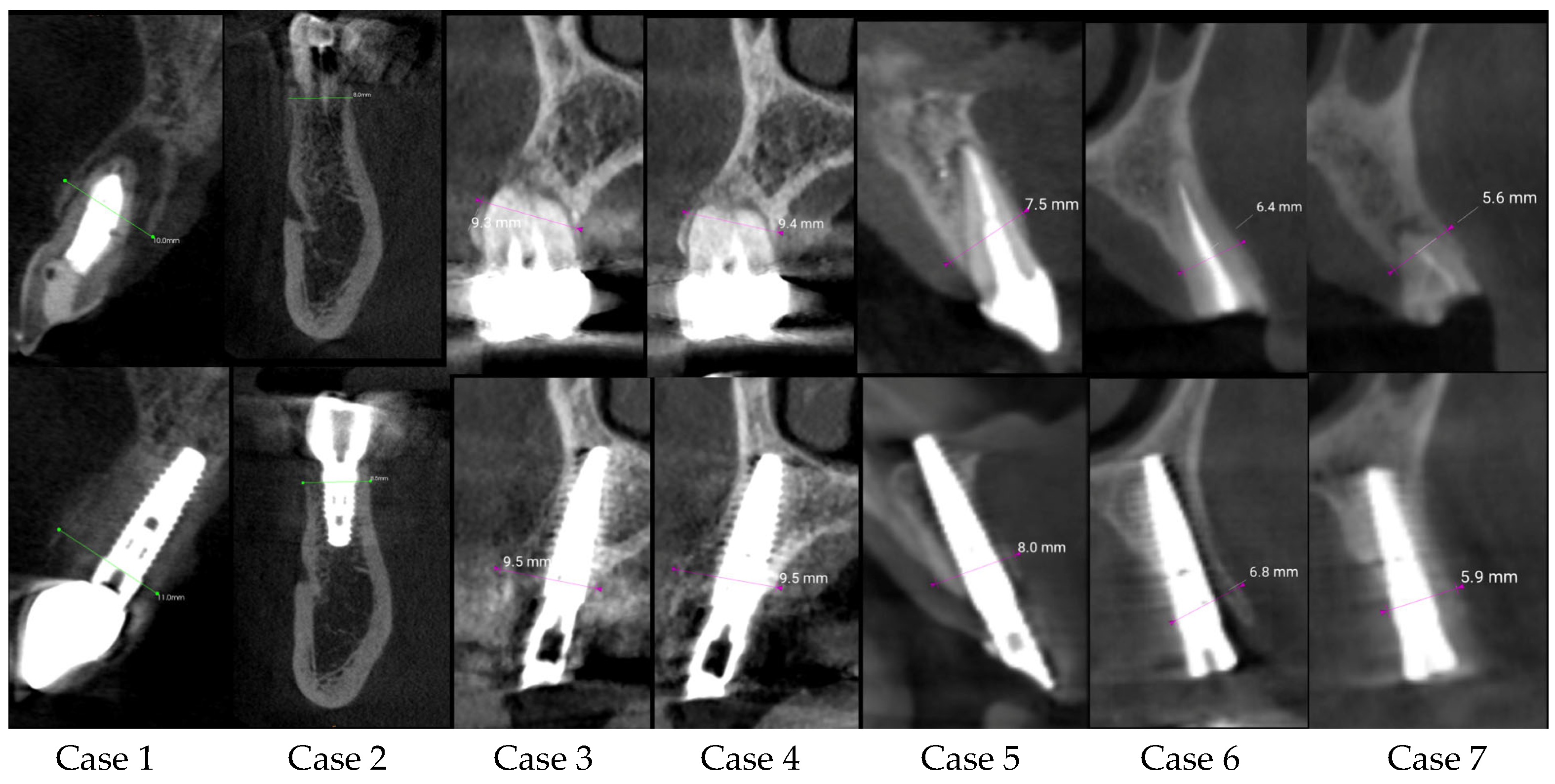 Applsci 13 09034 g008 Applsci 13 09034 g008