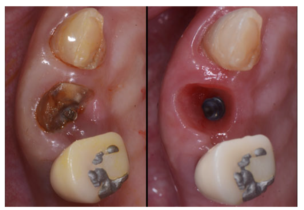 Applsci 13 09034 g011 Applsci 13 09034 g011