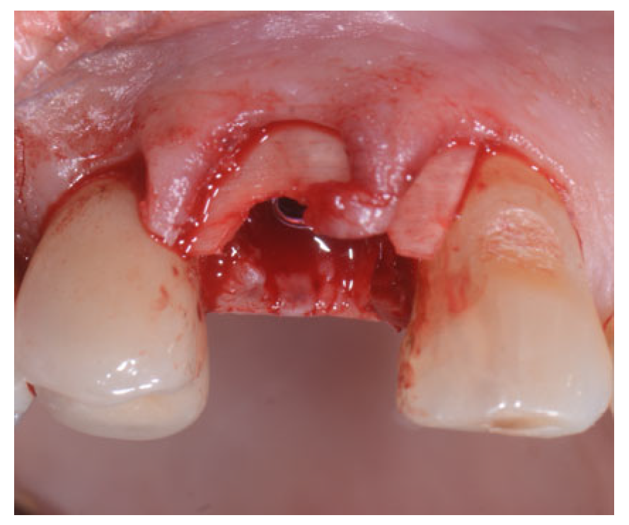 Applsci 13 09034 g012 Applsci 13 09034 g012