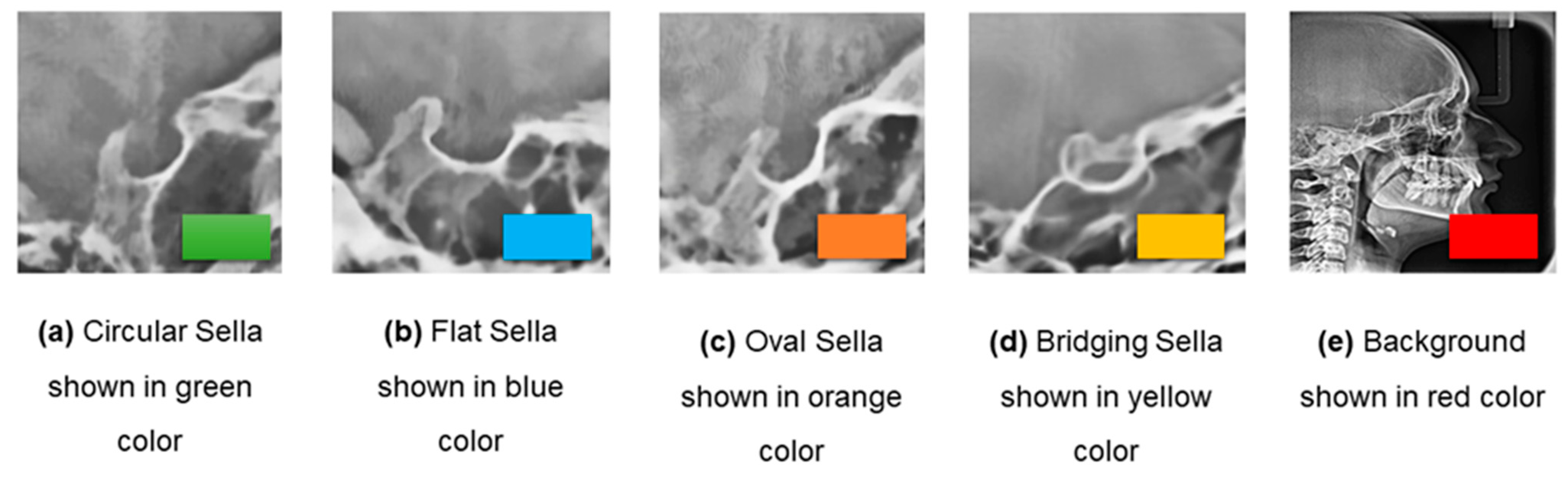 Applsci 13 09114 g006