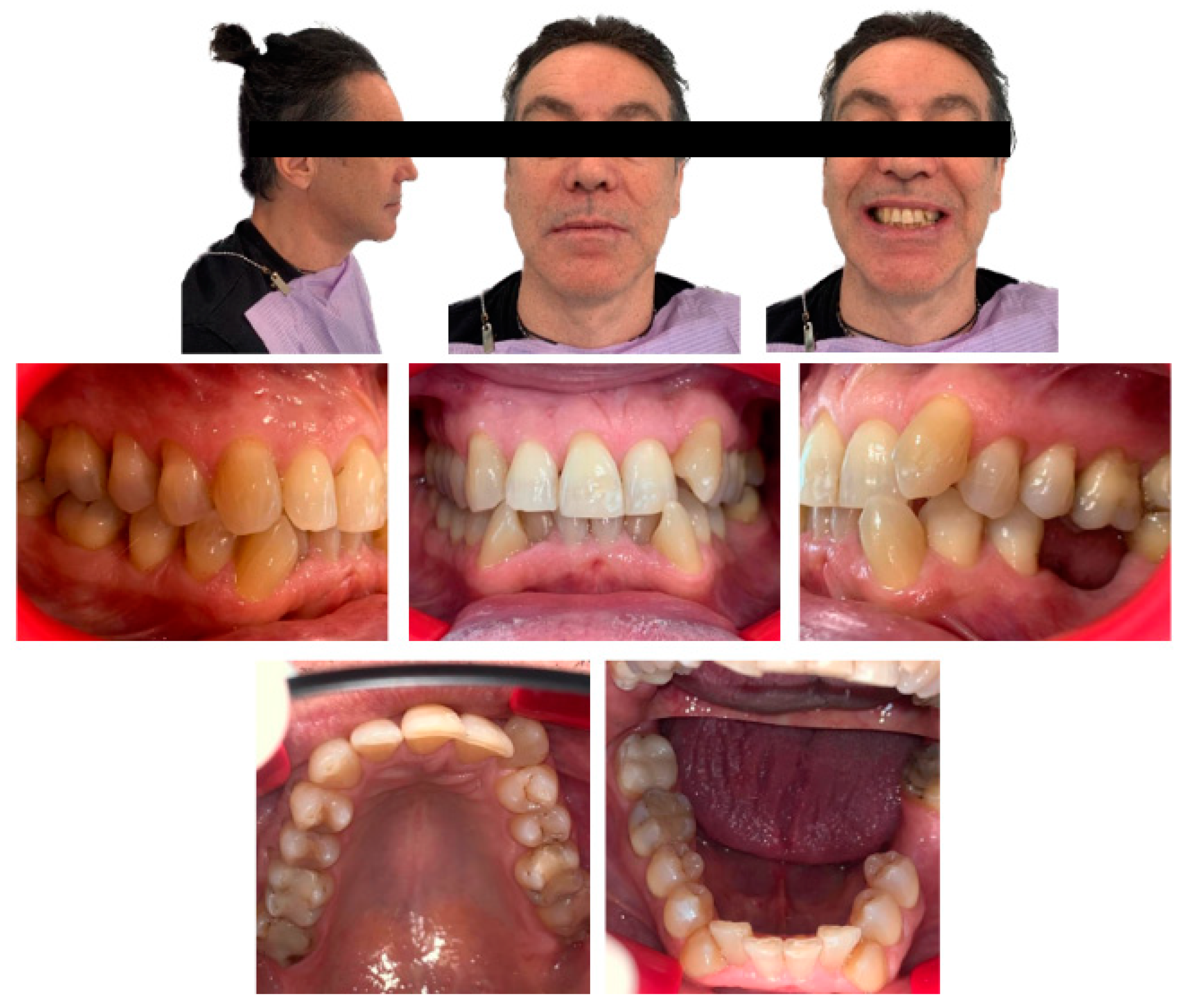 Applied Sciences Free FullText Photobiomodulation and Orthodontic