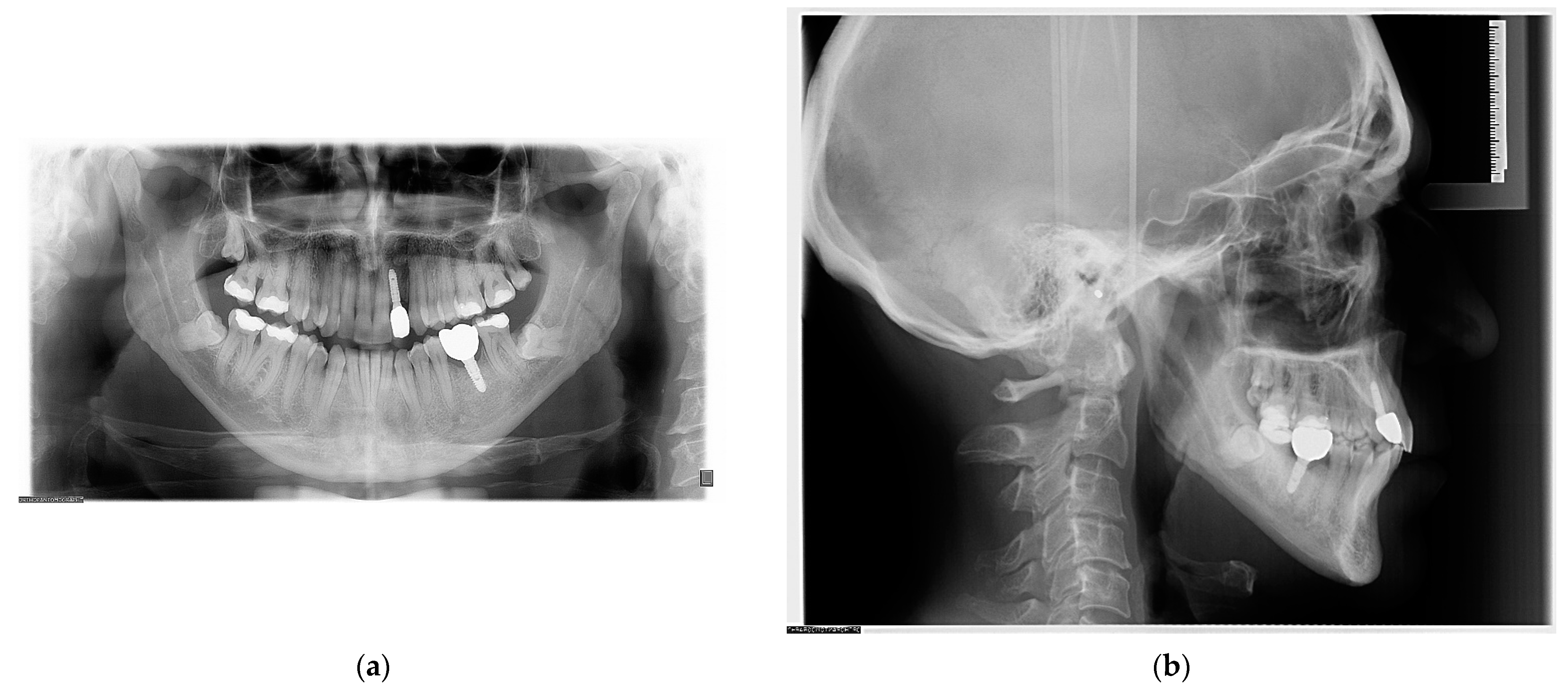 Applsci 13 09198 g006 Applsci 13 09198 g006