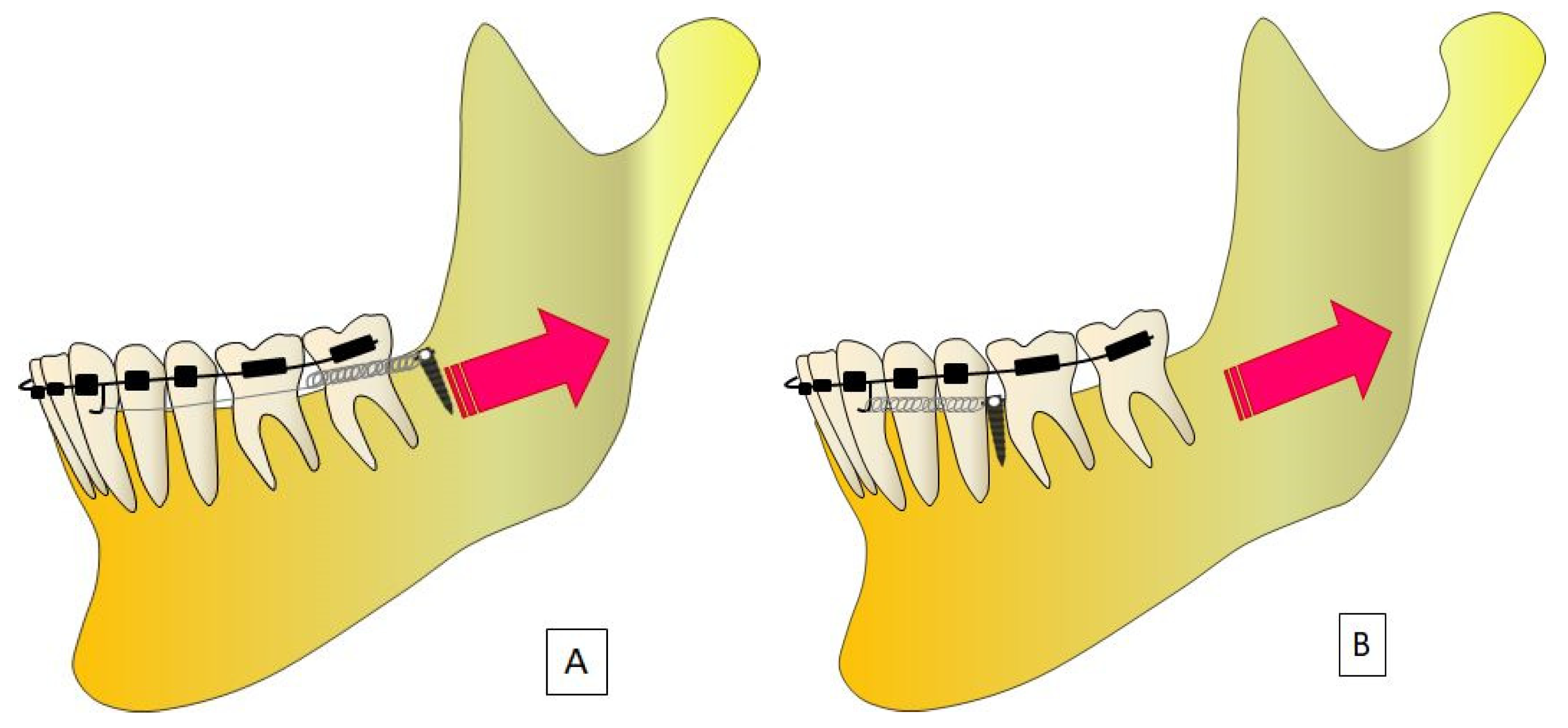 Applsci 13 09337 g004