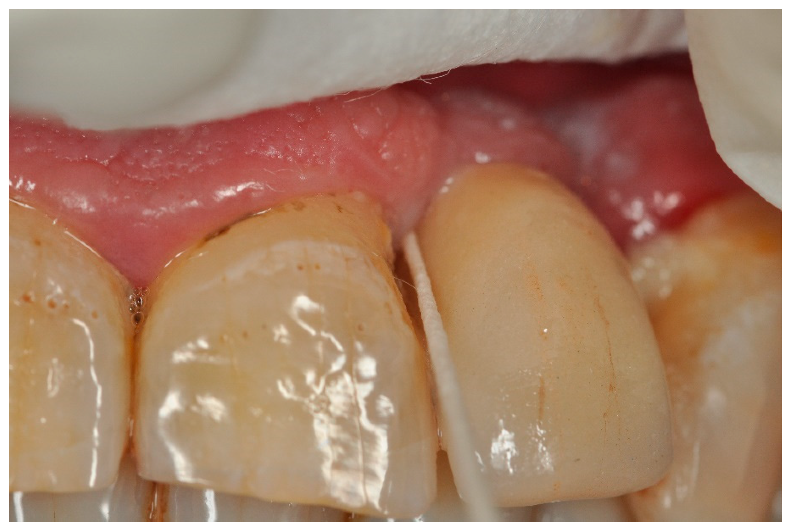 Applsci 13 09621 g003