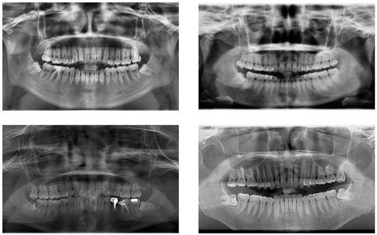 user Study on the Mechanical Behavior and Seepage Evolution Law of Deep