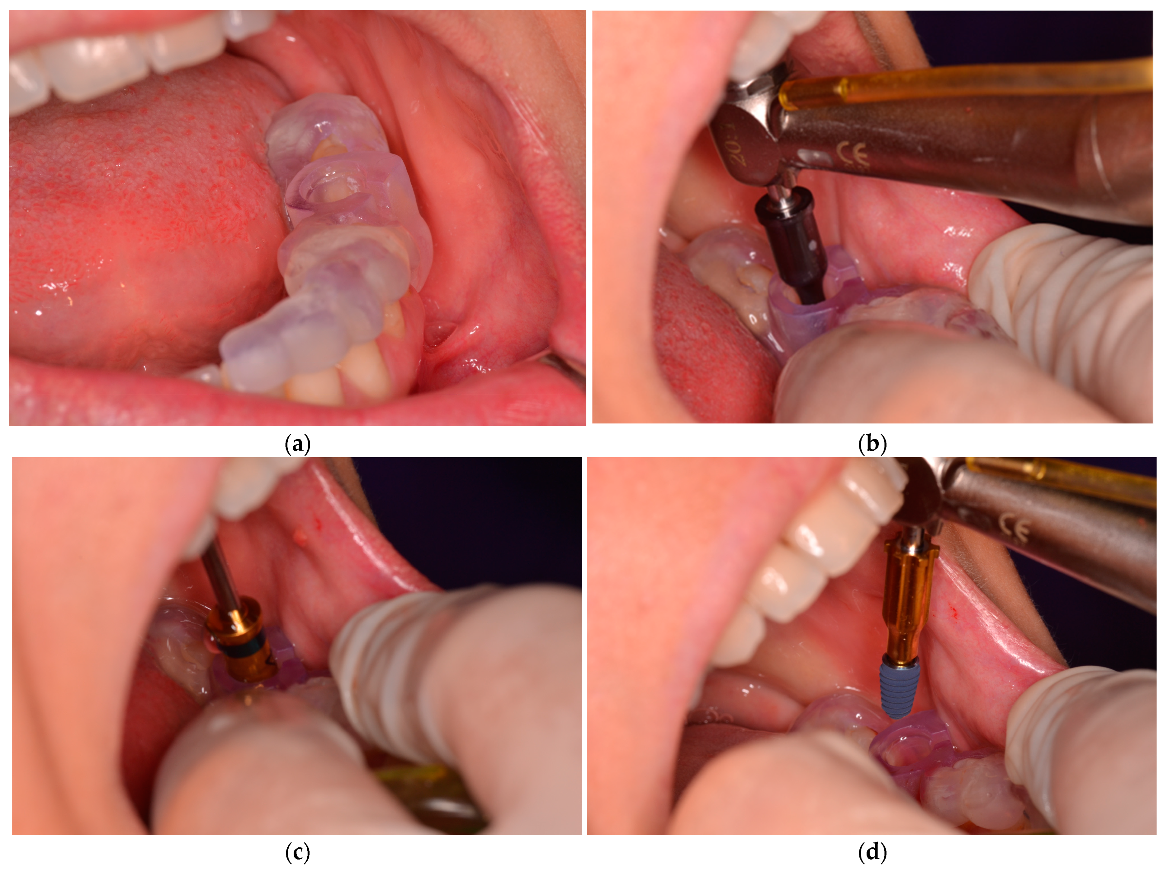 Applsci 13 09975 g006 Applsci 13 09975 g006