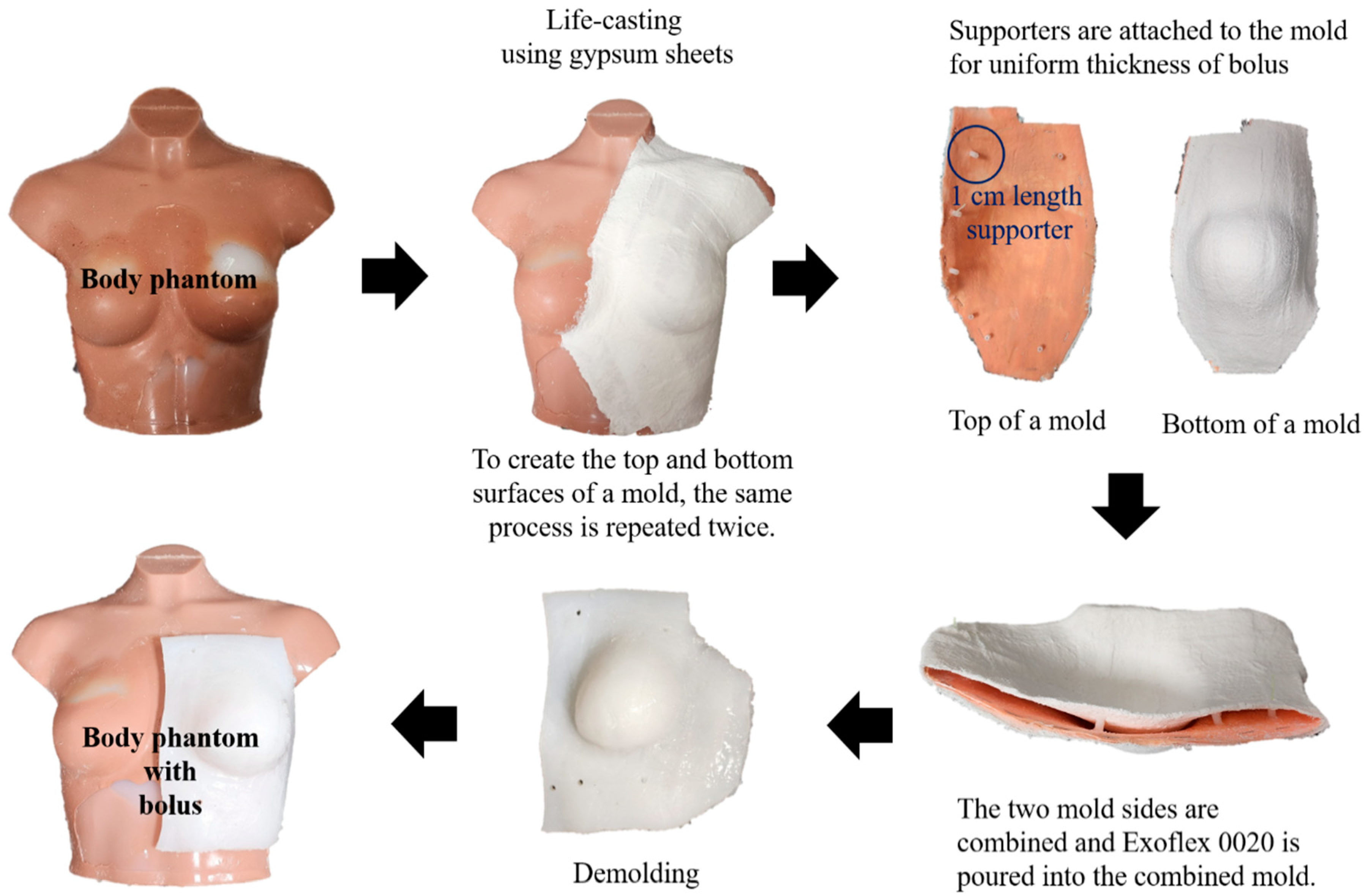 Feasibility of a Patient Specific Bolus Using the Life Casting Method for Radiation Therapy