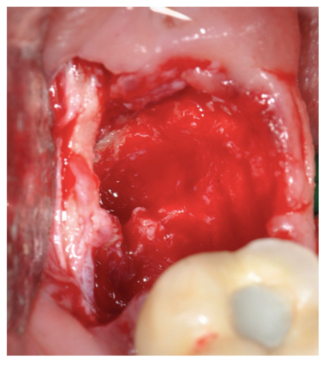 Applsci 13 10226 g005