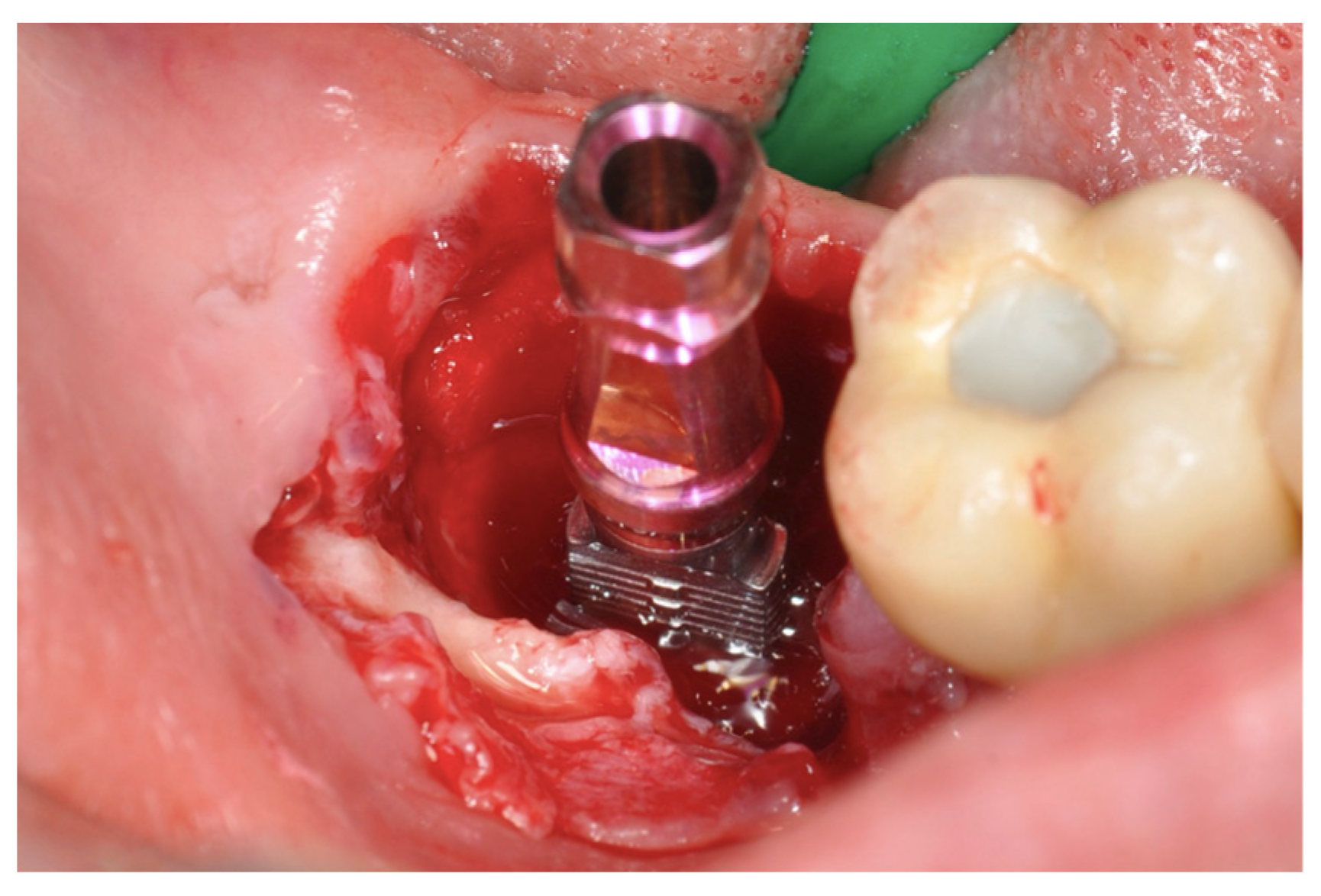 Applsci 13 10226 g006