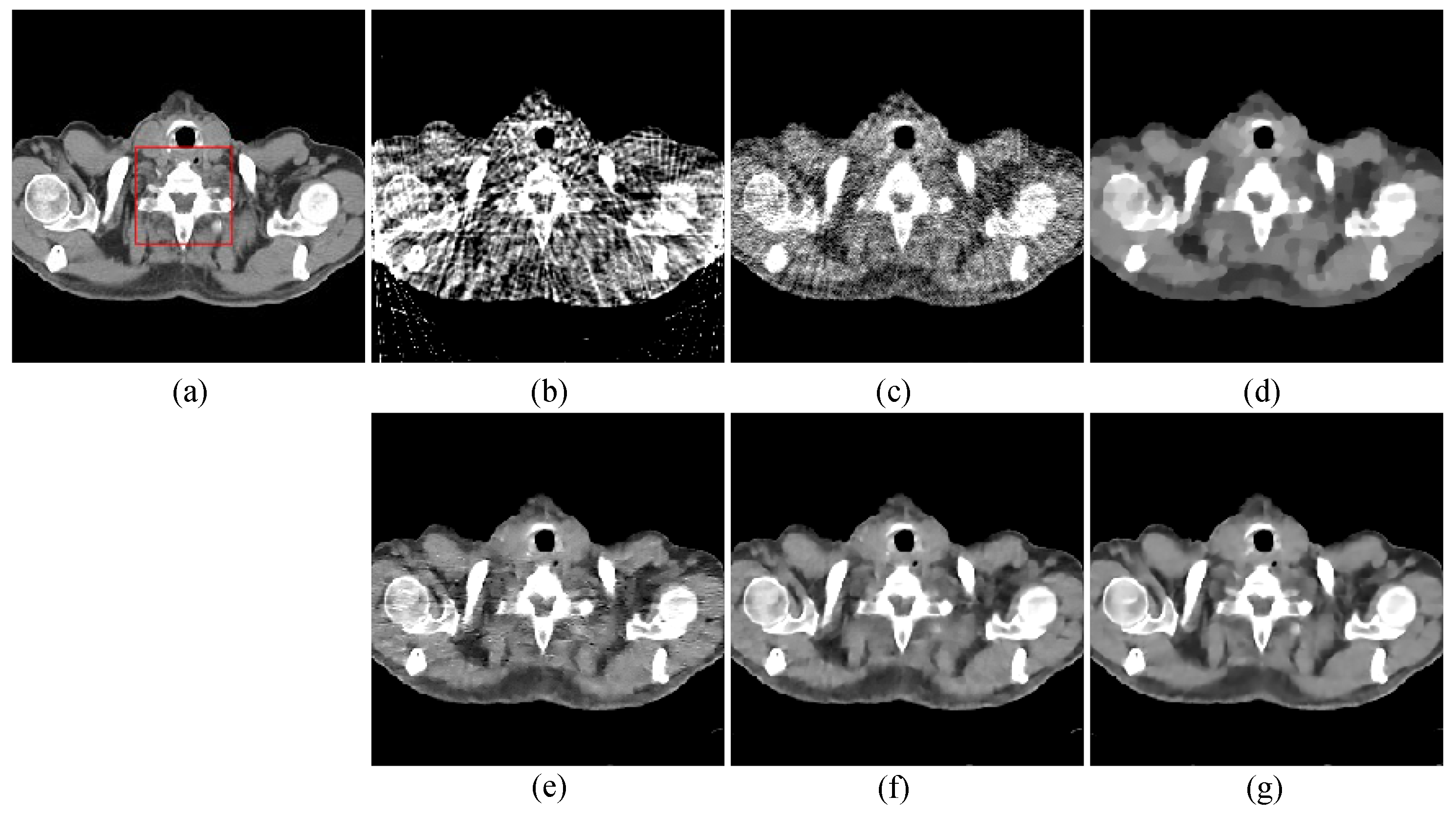 Sparse view computed tomography reconstruction based on a novel