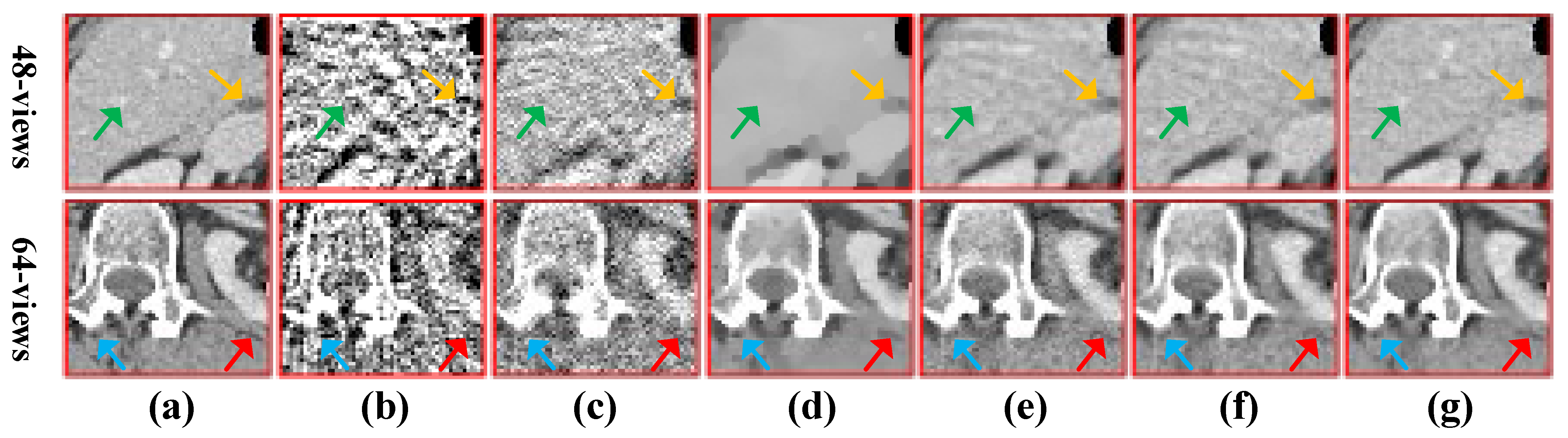 Sparse view computed tomography reconstruction based on a novel