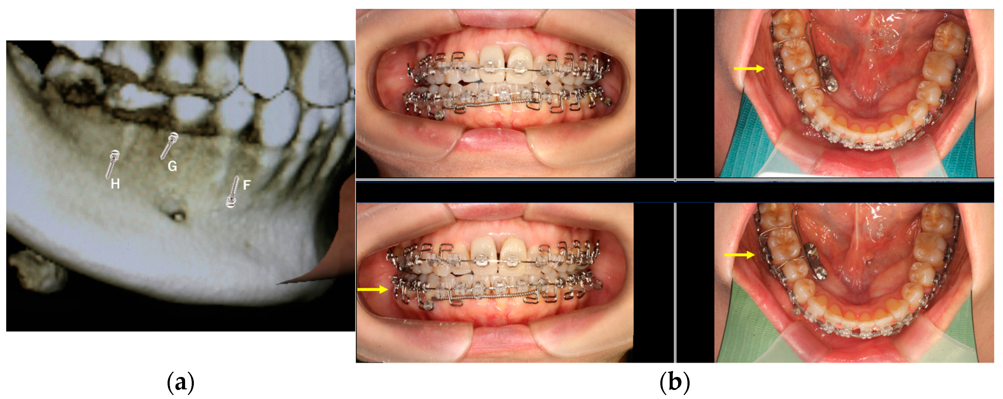 Applsci 13 10332 g003