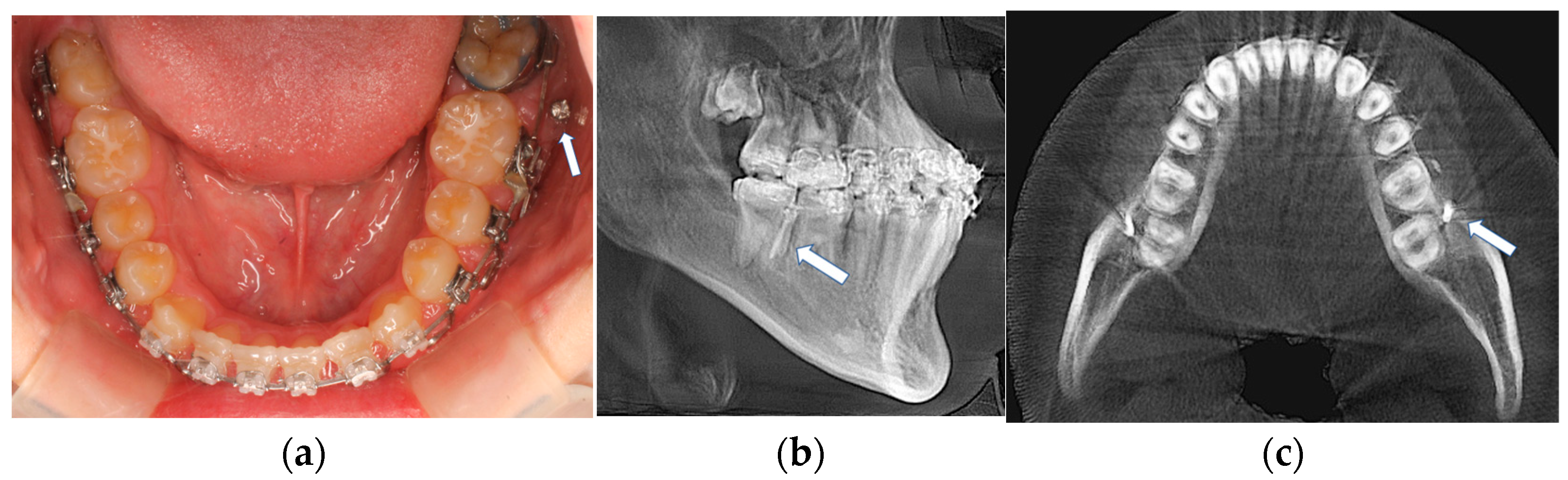 Applsci 13 10332 g004
