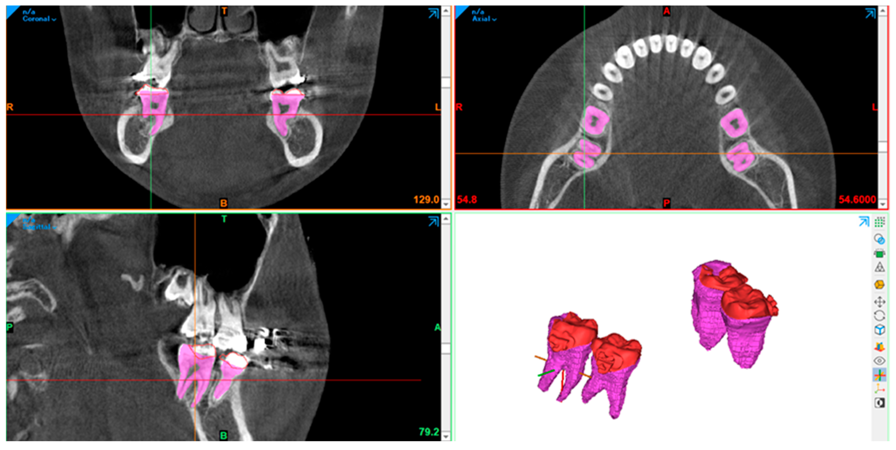Applsci 13 10332 g007