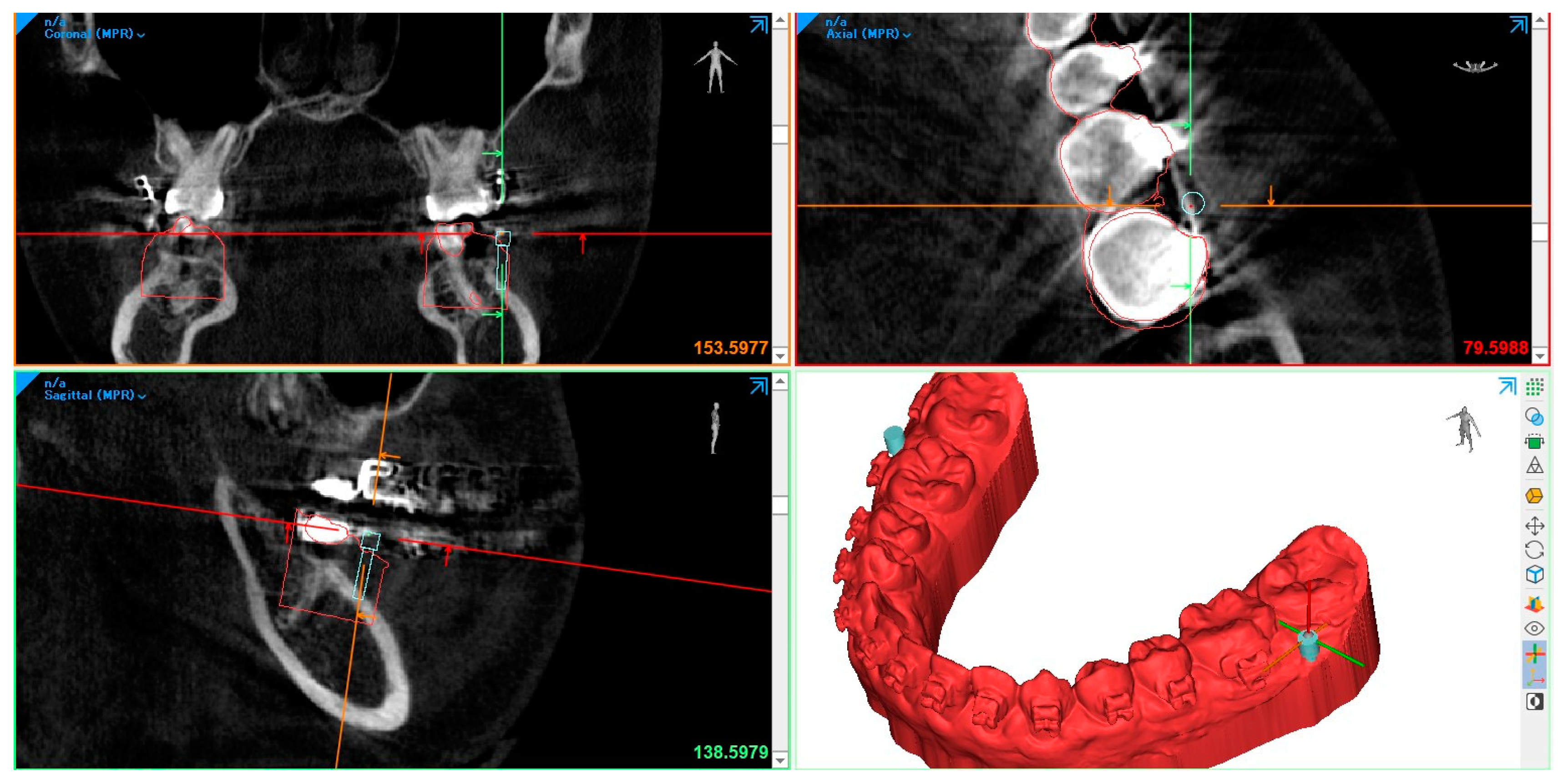 Applsci 13 10332 g009
