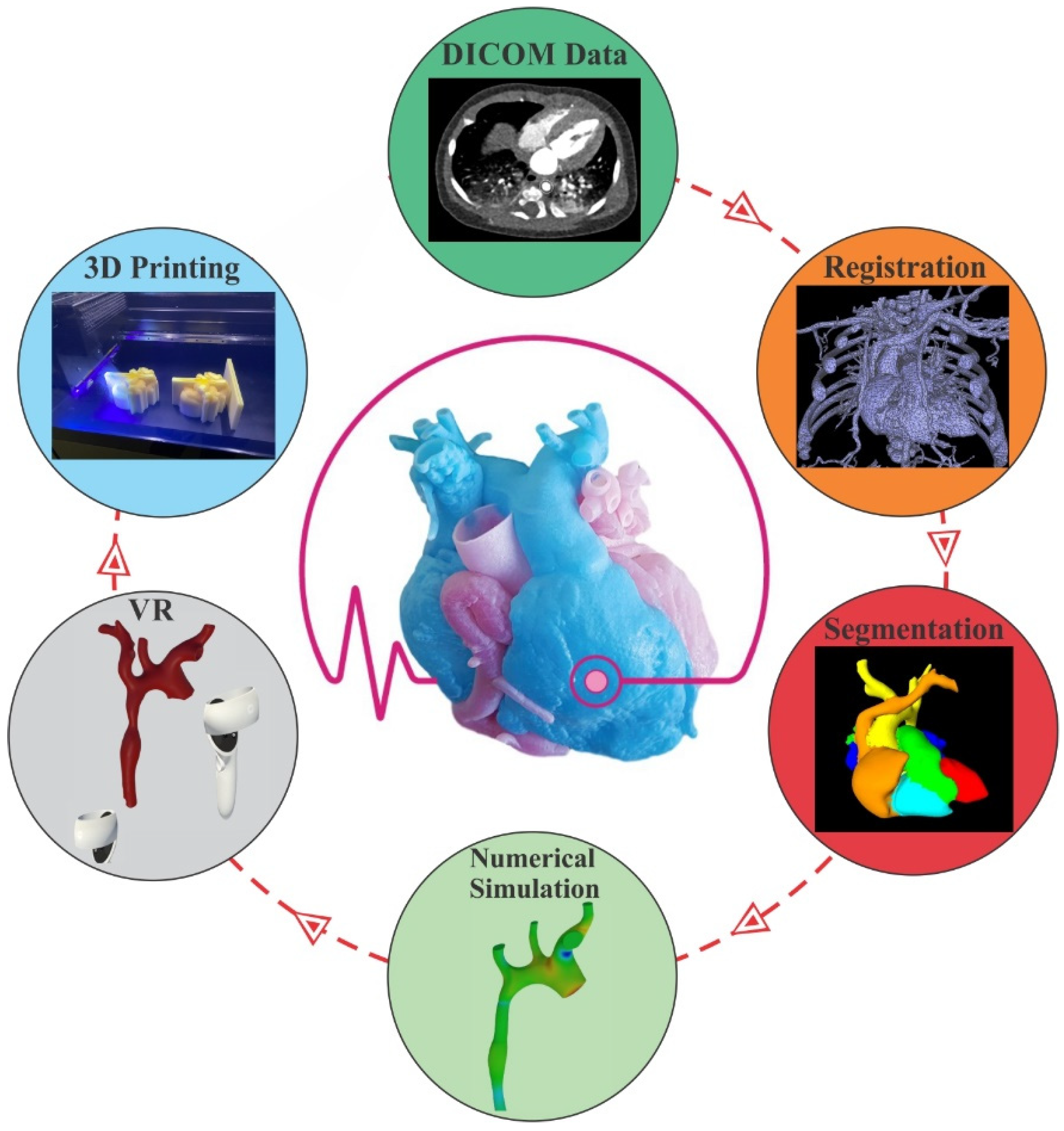 Examination of a Human Heart Fabricating Its 3D-Printed Cardiovascular ...