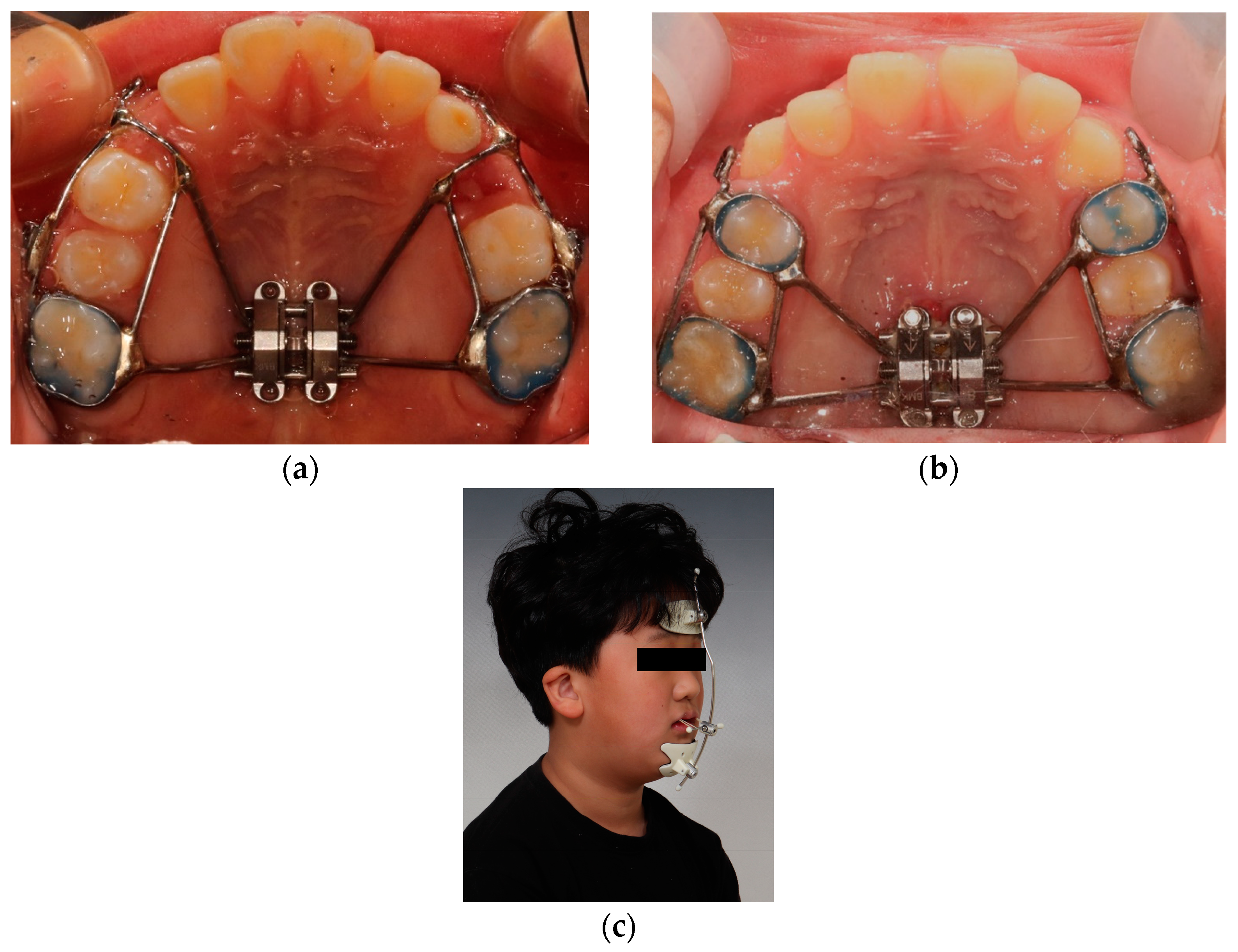 Applsci 13 10530 g001