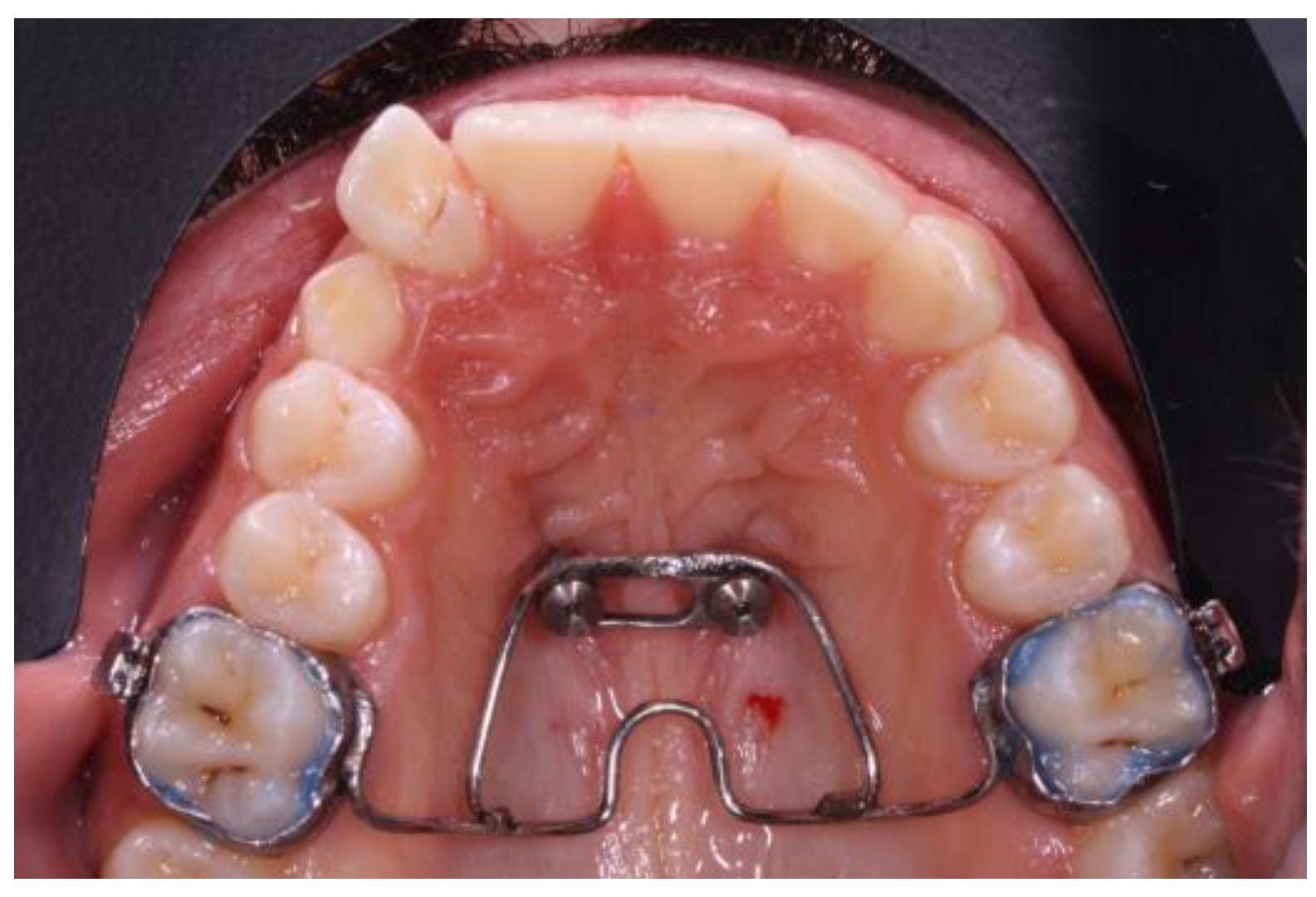 Applsci 13 11097 g002