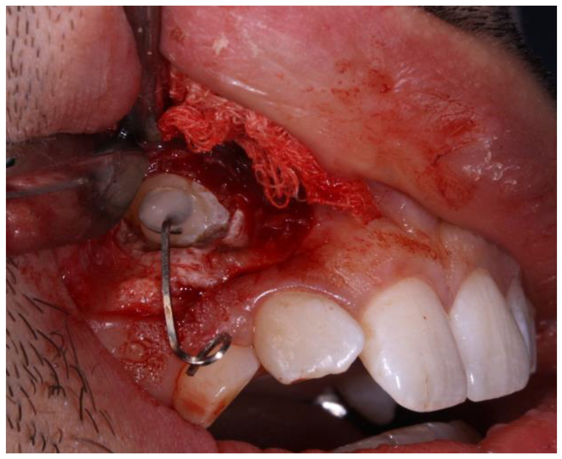 Applsci 13 11097 g011