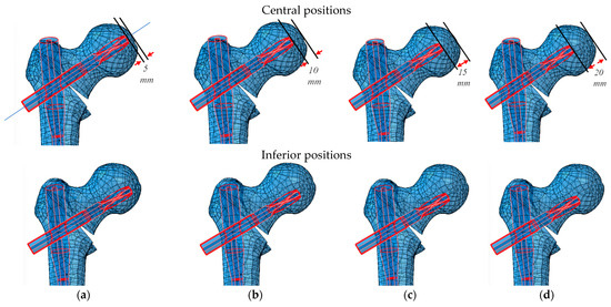 Damage-Based Assessment of the Risk of Cut-Out in Trochanteric 