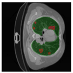 Applsci 13 11640 i033